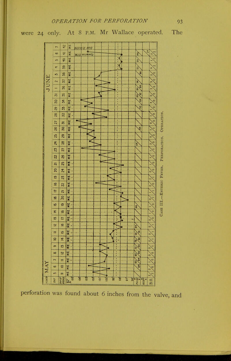 were 24 only. At 8 p.m. Mr Wallace operated. The perforation was found about 6 inches from the valve, and