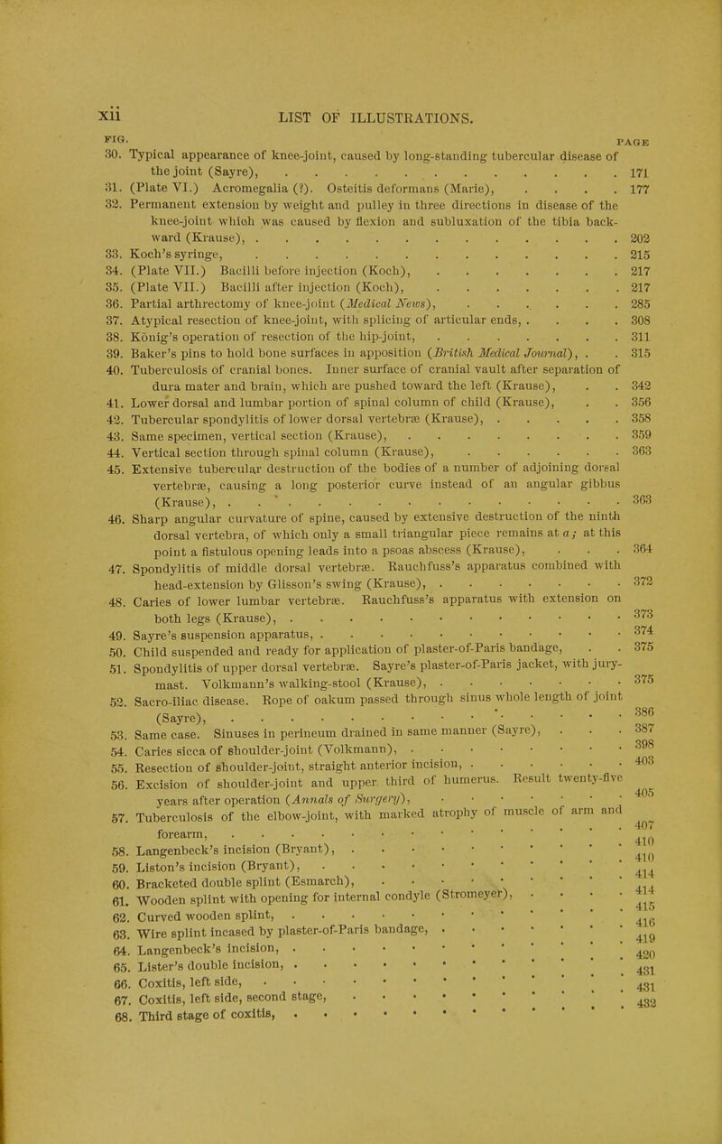 J'lG- PAGE 30. Typical appearance of knee-joint, caused by long-standing tubercular disease of the joint (Sayre), 171 31. (Plate VI.) Acromegalia (?). Osteitis deformans (Marie), . . . .177 33. Permanent extension by weight and pulley in three directions in disease of the knee-joint which was caused by flexion and subluxation of the tibia back- ward (Krause), 202 33. Koch's syringe, 215 34. (Plate VII.) Bacilli before injection (Koch), 217 35. (Plate VII.) Bacilli after injection (Koch), 217 36. Partial arthrectomy of knee-joint (Medical iVews), 285 37. Atypical resection of knee-joint, with splicing of articular ends, .... 308 38. Konig's operation of resection of the hip-joiut, 311 39. Baker's pins to hold bone surfaces in apposition (Brituh Medical Journal), . . 315 40. Tuberculosis of cranial bones. Inner surface of cranial vault after separation of dura mater and brain, which are pushed toward the left (Krause), , . 342 41. Lower dorsal and lumbar portion of spinal column of child (Krause), . . 3.56 42. Tubercular spondylitis of lower dorsal vertebrae (Krause), 358 43. Same specimen, vertical section (Krause), 359 44. Vertical section through spinal column (Krause), 363 45. Extensive tubercular destruction of the bodies of a number of adjoining dorsal vertebrae, causing a long posterior curve instead of an angular gibbus (Krause), . . ' 363 46. Sharp angular curvature of spine, caused by extensive destruction of the ninth dorsal vertebra, of which only a small triangular piece remains at a; at this point a fistulous opening leads into a psoas abscess (Krause), . . . 364 47. Spondylitis of middle dorsal vertebrae. Rauchfuss's apparatus combined with head-extension by Glisson's swing (Krause), 372 48. Caries of lower lumbar vertebrae. Rauchfuss's apparatus with extension on both legs (Krause), 373 49. Sayre's suspension apparatus, 374 .50. Child suspended and ready for application of plaster-of-Paris bandage, . . 375 51. Spondylitis of upper dorsal vertebrae. Sayre's plaster-of-Paris jacket, with jury- mast. Volkmann's walking-stool (Krause), 375 52. Sacro-iliac disease. Rope of oakum passed through sinus whole length of joint (Sayre), '^86 53. Same case. Sinuses in perineum drained in same manner (Sayre), . . .387 54. Caries sicca of shoulder-joint (Volkmann), 398 55. Resection of shoulder-joint, straight anterior incision, 403 56. Excision of shoulder-joint and upper third of humerus. Result twenty-flve years after operation {Annals of Surgery), 57 Tuberculosis of the elbow-joint, with marked atrophy of muscle of arm and . . • • 40( forearm, .58. Langenbeck's incision (Bryant), .59. Liston's incision (Bryant), 60. Bracketed double splint (Esmarch), 61. Wooden splint with opening for internal condyle (Stromeyer), . . • • 62. Curved wooden splint, 63. Wire splint incased by plaster-of-Paris bandage, 64. Langenbeck's incision, [ 420 65. Lister's double Incision, 66. Coxitis, left side, ' 67. Coxitis, left side, second stage, ] . 432 68. Third stage of coxitis,
