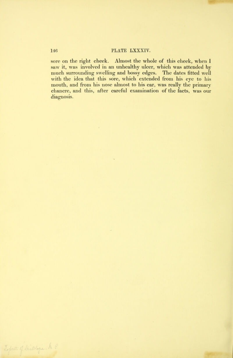 sore on the right eheek. Almost the whole of this cheek, when I saw it, was involved in an unhealthy ulcer, which was attended hy much surrounding swelling and bossy edges. The dates fitted well with the idea that this sore, which extended from his eye to his mouth, and from his nose almost to his ear, was really the primary chancre, and this, after careful examination of the facts, was our diagnosis.