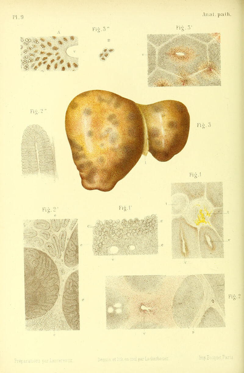 PI. 9