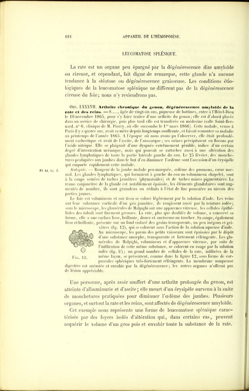 r 118 APPAREIL DE L’HÉMOPOIÈSE. LEUCOMATOSE SPLÉNIQUE. La rate est un organe peu épargné par la dégénérescence dite amyloïde ou cireuse, et cependant, fait digne de remarque, cette glande n’a aucune tendance à la stéatose ou dégénérescence graisseuse. Les conditions étio- logiques de la leucomatose splénique ne diffèrent pas de la dégénérescence cireuse du foie; nous n’y reviendrons pas. OBS. LXXX\ II. Arthrite chronique du genou, dégénérescence amyloïde de la rate et des reins. —S , âgée de vingt-six ans, piqueuse de bottines, entre à l’Hôtel-Dieu le 10 novembre 1865, pour s’y faire traiter d’une arthrite du genou; elle est d’abord placée dans un service de chirurgie, puis plus tard elle est transférée en médecine (salle Saint-Ber- nard, n° 6, clinique de M. Piorry, où elle succombe le 1er mars 1866). Cette malade, venue à Paris il y a quatre ans, avait sa mère depuis longtemps souffrante, et faisait remonter sa maladie au printemps de l’année 1865. A l’époque où nous avons pu l’observer, elle était profondé- ment cachectique et avait de l’ascite, de l’anasarque; ses urines précipitaient en flocons par l’acide nitrique. Elle se plaignait d’une dyspnée extrêmement pénible, indice d’un certain degré d’intoxication urémique, mais qui pouvait se rattacher aussi à une altération des glandes lymphatiques de toute la partie latérale gauche du cou. Le 25 février, des mouche- tures pratiquées aux jambes dans le but d’en diminuer l’œdème sont l’occasion d’un érysipèle qui emporte rapidement cette malade. pi u, fig. 2. Autopsie. — Rougeur de la jambe malade peu marquée, œdème des poumons, cœur nor- mal. Les glandes lymphatiques, qui formaient à gauche du cou un volumineux chapelet , sont à la coupe semées de taches jaunâtres (phymatoïdes) et de taches noires pigmentaires. La trame conjonctive de la glande est notablement épaissie, les éléments glandulaires sont aug- mentés de nombre, ils sont granuleux ou réduits à l’état de fine poussière au niveau des parties jaunes. Le foie est volumineux et son tissu se colore légèrement par la solution d’iode. Les reins ont leur substance corticale d’un gris jaunâtre, ils rougissent aussi par la teinture iodée ; sous le microscope, les gïomérules de Malpighi ont une apparence vitreuse, les cellules épithé- liales des tubuli sont finement grenues. La rate, plus que doublée de volume, a conservé sa forme, elle a une surface lisse, brillante, douce et onctueuse au toucher. Sa coupe, également lisse et brillante, présente sur un fond violacé des grains transparents, un peu inégaux et gri- sâtres (fig. 12), qui se colorent sous l’action de la solution aqueuse d’iode. Au microscope, les pai’ois des petits vaisseaux sont épaissies par le dépôt d’une substance amorphe, transparente et fortement réfringente. Les glo- mérules de Malpighi, volumineux et d’apparence vitreuse, par suite de l’infiltration de cette même substance, se colorent en rouge par la solution iodée (fig. h') ; un grand nombre de cellules de la rate, infiltrées de la pIG. 12. même façon, se présentent, comme dans la figure 12, sous forme de cor- puscules sphériques très-fortement réfringents. La membrane muqueuse digestive est anémiée et envahie par la dégénérescence ; les autres organes n’offrent pas de lésion appréciable. Une personne, après avoir souffert d’une arthrite prolongée du genou, est atteinte d’albuminurie et d’ascite ; elle meurt d’un érysipèle survenu à la suite de mouchetures pratiquées pour diminuer l’oedème des jambes. Plusieurs organes, et surtout la rate et les reins, sont affectés de dégénérescence amyloïde. Cet exemple nous représente une forme de leucomatose splénique carac- térisée par des foyers isolés d’altération qui, dans certains cas, peuvent acquérir le volume d’tm gros pois et envahir toute la substance de la rate.