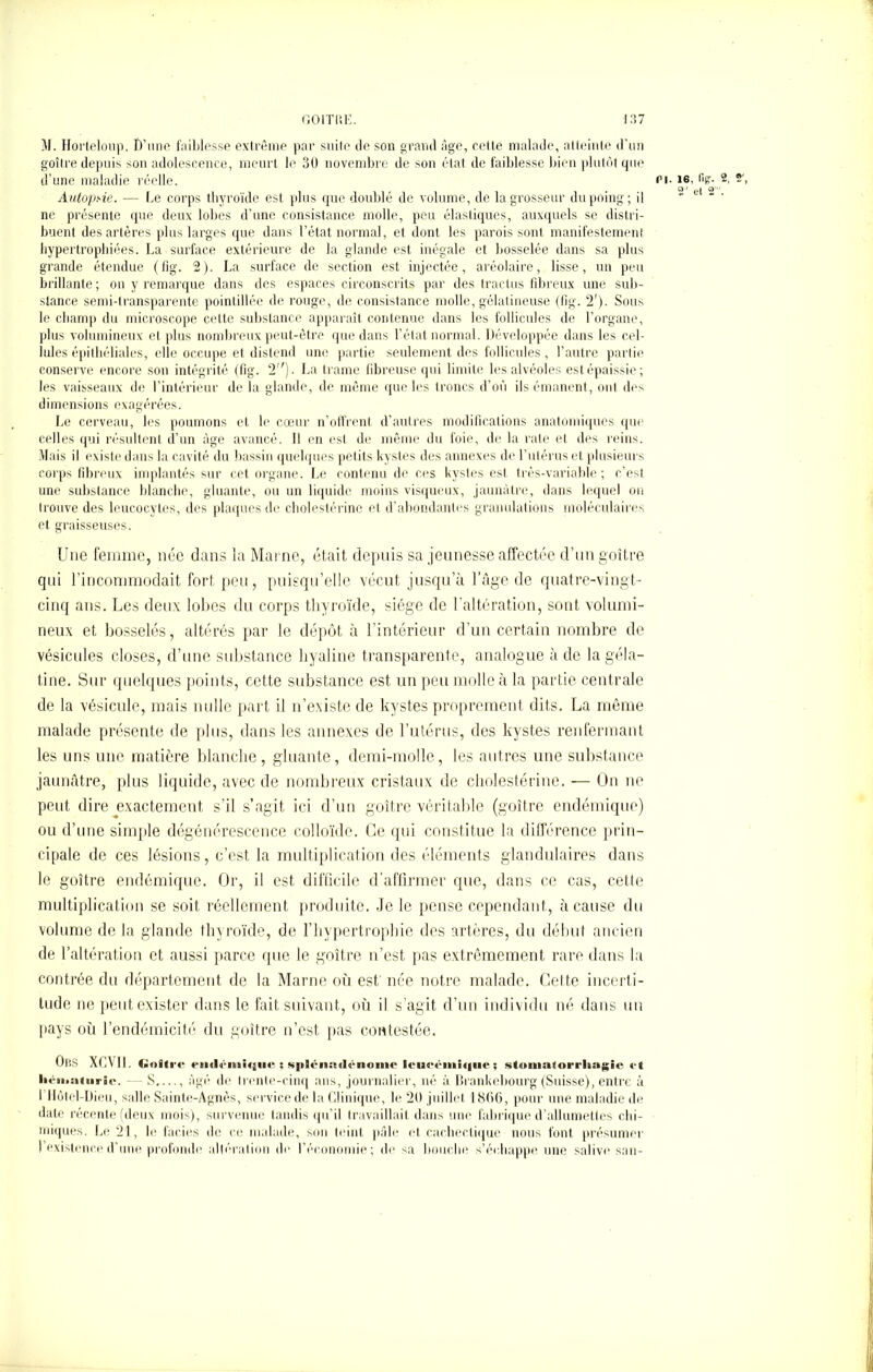 M. Horteloup. D'une faiblesse extrême par suite de son grand âge, cette malade, atteinte d’un goitre depuis sou adolescence, meurt le 30 novembre de son état de faiblesse bien plutôt que d’une maladie réelle. ri- >6. 2- Autopsie. — be corps thyroïde est plus que doublé de volume, de la grosseur du poing; il ne présente que deux lobes d’une consistance molle, peu élastiques, auxquels se distri- buent des artères plus larges que dans l’état normal, et dont les parois sont manifestement hypertrophiées. La surface extérieure de la glande est inégale et bosselée dans sa plus grande étendue (fig. 2). La surface de section est injectée, aréolaire, lisse, un peu brillante; on y remarque dans des espaces circonscrits par des tractus fibreux une sub- stance semi-transparente pointillée de rouge, de consistance molle, gélatineuse (fig. 2'). Sous le champ du microscope cette substance apparaît contenue dans les follicules de l’organe, plus volumineux et plus nombreux peut-être que dans l’état normal. Développée dans les cel- lules épithéliales, elle occupe et distend une partie seulement des follicules, l’autre partie conserve encore son intégrité (fig. 1). La trame fibreuse qui limite les alvéoles est épaissie; les vaisseaux de l’intérieur de la glande, de même que les troncs d’où ils émanent, ont des dimensions exagérées. Le cerveau, les poumons et le cœur n’offrent d’autres modifications anatomiques que celles qui résultent d’un âge avancé. Il en est de même du foie, de la rate et des reins. Mais il existe dans la cavité du bassin quelques petits kystes des annexes de l’utérus et plusieurs corps fibreux implantés sur cet organe. Le contenu de ces kystes est très-variable; c’est une substance blanche, gluante, ou un liquide moins visqueux, jaunâtre, dans lequel ou trouve des leucocytes, des plaques de cholestérine et d’abondantes granulations moléculaires et graisseuses. Une femme, née dans la Marne, était depuis sa jeunesse affectée d’un goitre qui l’incommodait fort peu, puisqu’elle vécut jusqu’à l’âge de quatre-vingt- cinq ans. Les deux lobes du corps thyroïde, siège de l’altération, sont volumi- neux et bosselés, altérés par le dépôt à l’intérieur d’un certain nombre de vésicules closes, d’une substance hyaline transparente, analogue à de la géla- tine. Sur quelques points, cette substance est un peu molle à la partie centrale de la vésicule, mais nulle part il n’existe de kystes proprement dits. La même malade présente de plus, dans les annexes de l’utérus, des kystes renfermant les uns une matière blanche, gluante, demi-molle, les autres une substance jaunâtre, plus liquide, avec de nombreux cristaux de cholestérine. — On ne peut dire exactement s’il s’agit ici d’un goitre véritable (goitre endémique) ou d’une simple dégénérescence colloïde. Ce qui constitue la différence prin- cipale de ces lésions, c’est la multiplication des éléments glandulaires dans le goitre endémique. Or, il est difficile d’affirmer que, dans ce cas, cette multiplication se soit réellement produite. .Je le pense cependant, à cause du volume de la glande thyroïde, de l’hypertrophie des artères, du début ancien de l’altération et aussi parce que le goitre n’est pas extrêmement rare dans la contrée du département de la Marne où est née notre malade. Celte incerti- tude ne peut exister dans le fait suivant, où il s’agit d’un individu né dans un pays où l’endémicité du goitre n’est pas contestée. OlîS XCVI1. t»»iti-<- enili ■inique ; splénmlénonie lcueémi<|iic ; stumatorrhagic et hématurie. - S âgé de trente-cinq ans, journalier, né à Brankebourg (Suisse), entre à 1 Hôtel-Dieu, salle Sainte-Agnès, service de la Clinique, le 20 juillet 1866, pour une maladie de date récente (deux mois), survenue tandis qu’il travaillait dans une fabrique d’allumettes chi- miques. Le 21, le faciès de ce malade, son teint pâle et cachectique nous font présumer 1 existence d’une profonde altération de l’économie; de sa bouche s’échappe une salive san-