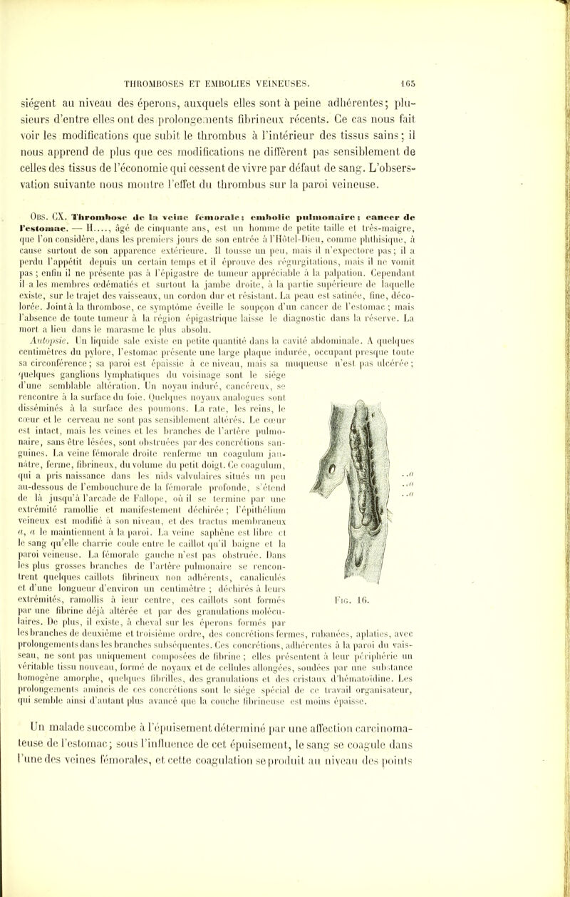 siègent au niveau des éperons, auxquels elles sont à peine adhérentes; plu- sieurs d’entre elles ont des prolongements fibrineux récents. Ce cas nous fait voir les modifications que subit le thrombus à l’intérieur des tissus sains ; il nous apprend de plus que ces modifications ne diffèrent pas sensiblement de celles des tissus de l’économie qui cessent de vivre par défaut de sang. L’obsers- vation suivante nous montre l’effet du thrombus sur la paroi veineuse. ÜBS. GX. Thrombose de 1» veine fémorale; embolie pulmonaire ; eanecr de l’estomac. — II , âgé de cinquante ans, est un homme de petite taille et très-maigre, que l’on considère, dans les premiers jours de son entrée à l’Hôtel-Dieu, comme phthisique, à cause surtout de son apparence extérieure. 11 tousse un peu, mais il n’expectore pas; il a perdu l’appétit depuis un certain temps et il éprouve des régurgitations, mais il ne vomit pas ; enfin il ne présente pas à l’épigastre de tumeur appréciable à la palpation. Cependant il aies membres œdématiés et surtout la jambe droite, à la partie supérieure de laquelle existe, sur le trajet des vaisseaux, un cordon dur et résistant. La peau est satinée, fine, déco- lorée. Jointà la thrombose, ce symptôme éveille le soupçon d’un cancer de l’estomac; mais l’absence de toute tumeur à la région épigastrique laisse le diagnostic dans la réserve. La mort a lieu dans le marasme le plus absolu. Autopsie. Un liquide sale existe en petite quantité dans la cavité abdominale. A quelques centimètres du pylore, l’estomac présente une large plaque indurée, occupant presque toute sa circonférence ; sa paroi est épaissie à ce niveau, mais sa muqueuse n’est pas ulcérée ; quelques ganglions lymphatiques du voisinage sont le siège d’une semblable altération. Un noyau induré, cancéreux, se rencontre à la surface du foie. Quelques noyaux analogues sont disséminés à la surface des poumons. La rate, les reins, le cœur et le cerveau ne sont pas sensiblement altérés. Le cœur est intact, mais les veines et les branches de l’artère pulmo- naire, sans être lésées, sont obstruées par des concrétions san- guines. La veine fémorale droite renferme un coagulum jau- nâtre, ferme, fibrineux, du volume du petit doigt. Ce coagulum, qui a pris naissance dans les nids valvulaires situés un peu au-dessous de l’embouchure de la fémorale profonde, s’étend de là jusqu’à l’arcade de Fallope, où il se termine par une extrémité ramollie et manifestement déchirée ; l’épithélium veineux est modifié à son niveau, et des tractus membraneux fl, « le maintiennent à la paroi. La veine saphène est libre et le sang qu’elle charrie coule entre le caillot qu’il baigne et. la paroi veineuse. La fémorale gauche n’est pas obstruée. Dans les plus grosses branches de l’artère pulmonaire se rencon- trent quelques caillots fibrineux non adhérents, canaliculés et d’une longueur d’environ un centimètre ; déchirés à leurs extrémités, ramollis à ieur centre, ces caillots sont formés par une fibrine déjà altérée et par des granulations molécu- laires. De plus, il existe, à cheval sur les éperons formés par les branches de deuxième et troisième ordre, des concrétions fermes, rubanées, aplaties, avec prolongements dans les branches subséquentes. Ces concrétions, adhérentes à la paroi du vais- seau, ne sont pas uniquement composées de fibrine; elles présentent à leur périphérie un véritable tissu nouveau, formé de noyaux et de cellules allongées, soudées par une substance homogène amorphe, quelques fibrilles, des granulations et des cristaux d'hématoïdine. Les prolongements amincis de ces concrétions sont le siège spécial de ce travail organisateur, qui semble ainsi d’autant plus avancé que la couche fibrineuse est moins épaisse. Un malade succombe à l’épuisement déterminé par une affection carcinoma- teuse de l’estomac; sous l’influence de cet épuisement, le sang se coagule dans l’une des veines fémorales, et cette coagulation seproduit au niveau des points Fm. lfi.