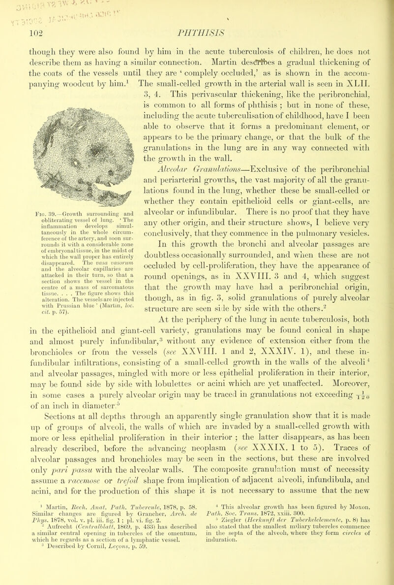 vv; ^ ’ tliongli they were also found by him in the acute tuberculosis of children, he does not describe them as having a similar connection. Martin des(!Tfbes a gradual thickening of the coats of the vessels until they are ‘ complely occluded,’ as is shown in the accom- panying woodcut by him,^ The small-celled growth in the arterial wall is seen in XLII. 3, 4. This perivascular thickening, like the peribronchial, is common to all forms of phthisis ; but in none of these, including the acute tuberculisation of childhood, have I been able to observe that it forms a predominant element, or appears to be the primary change, or that the bulk of the granulations in the lung are in any way connected with the growth in the wall. Alveolar Granulations—Exclusive of the peribronchial and periarterial growths, the vast majority of all the granu- lations found in the lung, whether these be small-celled or whether they contain epithelioid cells or giant-cells, are alveolar or infundibular. There is no proof that they have any other origin, and their structure shows, I believe very conclusively , that they commence in the pulmonary vesicles. In this growth the bronchi and alveolar passages are doubtless occasionally surrounded, and when these are not occluded by cell-proliferation, they have the appearance of round openings, as in XXVIII. 3 and 4, which suggest that the growth may have had a peribronchial origin, though, as in tig. 3, solid granulations of purely alveolar structure are seen side by side with the others.^ At the periphery of the lung in acute tuberculosis, both in the epithelioid and giant-cell variety, granulations may be found conical in shape and almost purely infundibular,^ without any evidence of extension either from the bronchioles or from the vessels [see XXVIII. 1 and 2, XXXIV. 1), and these in- fundibular intiltrations, consisting of a small-celled growth in the walls of the alveoli'^ and alveolar passages, mingled with more or less epithelial proliferation in their interior, may be found side by side with lobulettes or acini which are yet unaffected. Moreover, in some cases a purely alveolar origin may be traced in granulations not exceeding of an inch in diameter.® Sections at all depths through an apparently single granulation show that it is made up of groups of alveoli, the walls of which are invaded by a small-celled growth with more or less epithelial proliferation in their interior ; the latter disappears, as has been already described, before the advancing neoplasm [see XXXIX. 1 to 5). Traces of alveolar passages and bronchioles may be seen in the sections, but these are involved only jjari f>assu with the alveolar walls. Ihe composite granulation must of necessity assume a racemose or trefoil shape from implication of adjacent alveoli, infundibula, and acini, and for the production of this shape it is not necessary to assume that the new Fig. 39.—Growth surrouncling and obliterating vessel of lung. ‘ The inflammation develops simul- taneously in the whole circum- ference of the artery, and soon sur- rounds it with a considerable zone of embryonal tissue, in the midst of which the wall ]iroper has entirely disappeared. The vasa vasorum and the alveolar capillaries are attacked in their turn, so that a section shows the vessel in the centre of a mass of sarcomatous tissue. . . . The figure shows this alteration. The vessels are injected with Prussian blue ’ (Martin, loc. cit. 13. 57). 1 Martin, Becli. Anat. Path. Tubercule, 1878, p. 58. Similar changes are figured by Grancher, Arch, de Phys. 1878, vol. v. pi. iii. tig. 1; pi. vi. fig. 2. Aufrecht {CentraIhtatt, 1869, p. 433) has described a similar central opening in tubercles of the omentum, which he regards as a section of a lymphatic vessel. ® Described by Cornil, Lecons, p. 59. * This alveolar growth has been figured by Moxon, Path. Soc. Trans. 1872, xxiii. 300. ® Ziegler {Herkunft der Tuherkelelemente, p. 8) has also stated that the smallest miliary tubercles commence in the septa of the alveoli, where they form circles of induration.