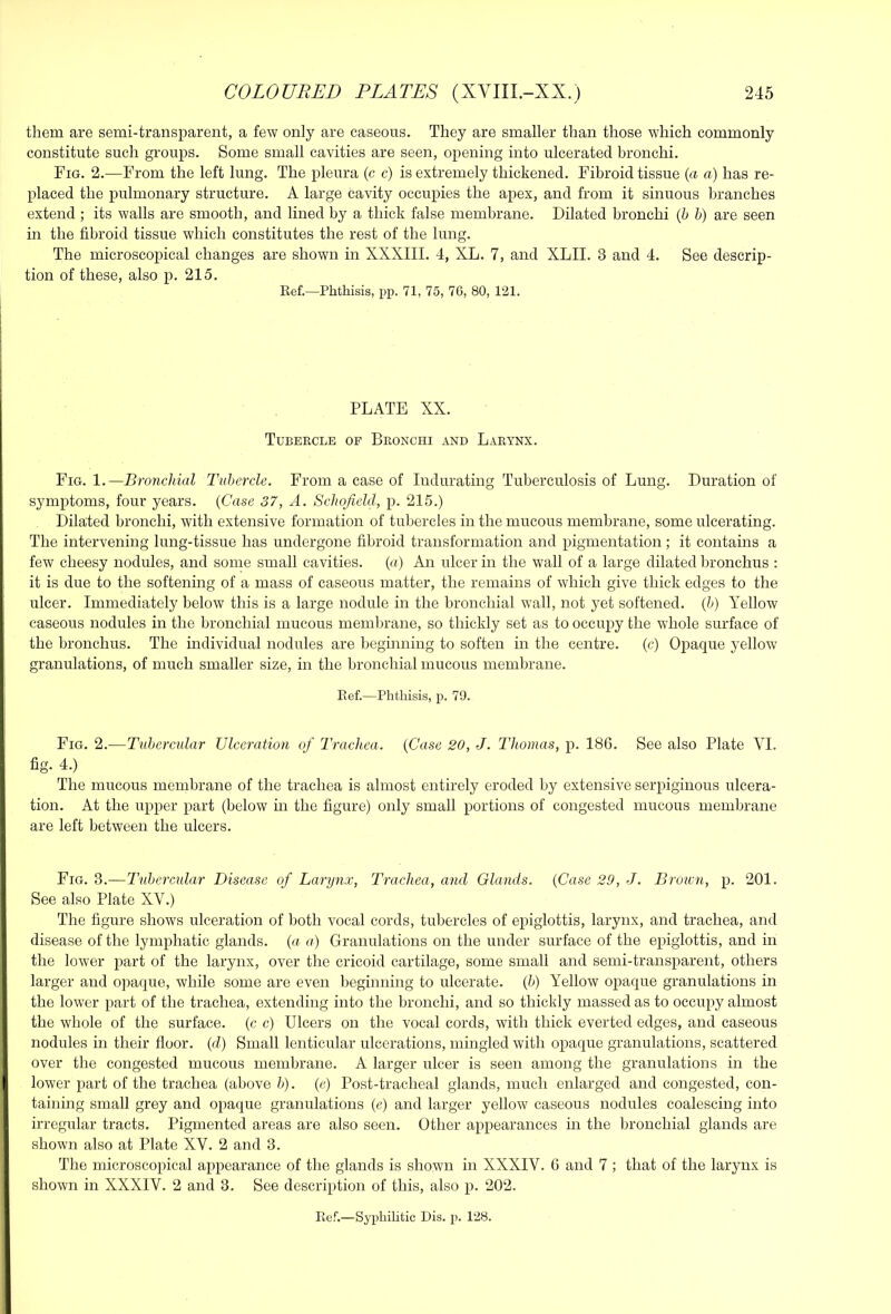 them are semi-transparent, a few only are caseous. They are smaller than those which commonly constitute such groups. Some small cavities are seen, opening into ulcerated bronchi. Fig. 2.—From the left lung. The pleura (c c) is extremely thickened. Fibroid tissue {a a) has re- placed the pulmonary structure. A large cavity occupies the apex, and from it sinuous branches extend ; its walls are smooth, and lined by a thick false membrane. Dilated bronchi {h h) are seen in the fibroid tissue which constitutes the rest of the lung. The microscopical changes are shown in XXXIII. 4, XL. 7, and XLII. 3 and 4. See descrip- tion of these, also p. 215. Kef.—Phthisis, pp. 71, 75, 76, 80, 121. ! PLATE XX. Tubercle of Bronchi and Larynx. Fig. 1.—Bronchial Tubercle. From a case of Indurating Tuberculosis of Lung. Duration of symptoms, four years. {Case 37, A. Schofield, p. 215.) Dilated bronchi, with extensive formation of tubercles in the mucous membrane, some ulcerating. The intervening lung-tissue has undergone fibroid transformation and pigmentation ; it contains a few cheesy nodules, and some small cavities, (u) An ulcer in the wall of a large dilated bronchus : it is due to the softening of a mass of caseous matter, the remains of which give thick edges to the ulcer. Immediately below this is a large nodule in the bronchial wall, not yet softened, {h) Yellow caseous nodules in the bronchial mucous membrane, so thickly set as to occupy the whole surface of the bronchus. The individual nodules are beginning to soften in the centre. (c) Opaque yellow granulations, of much smaller size, in the bronchial mucous membrane. Kef.—Phthisis, p. 79. Fig. 2.—Tubercular Ulceration of Trachea. {Case 20, J. Thomas, p. 186. See also Plate VI. fig. 4.) The mucous membrane of the trachea is almost entirely eroded by extensive seiquginous ulcera- tion. At the upper part (below in the figure) only small portions of congested mucous membrane are left between the ulcers. Fig. 3.—Tubercular Disease of Larynx, Trachea, and Glands. {Case 29, J. Broien, p. 201. See also Plate XV.) The figure shows ulceration of both vocal cords, tubercles of epiglottis, larynx, and trachea, and disease of the lymphatic glands, {a a) Granulations on the under surface of the epiglottis, and in the lower part of the larynx, over the cricoid cartilage, some small and semi-transparent, others larger and ojiaque, while some are even beginning to ulcerate, {b) Yellow opaque granulations in the lower part of the trachea, extending into the bronchi, and so thickly massed as to occupy almost the whole of the surface, (c c) Ulcers on the vocal cords, with thick everted edges, and caseous nodules in their floor, {d) Small lenticular ulcerations, mingled with opaque granulations, scattered over the congested mucous membrane. A larger ulcer is seen among the granulations in the ( lower part of the trachea (above 5). {e) Post-tracheal glands, much enlarged and congested, con- taining small grey and opaque granulations {e) and larger yellow caseous nodules coalescing into I irregular tracts. Pigmented areas are also seen. Other appearances in the bronchial glands are ^ shown also at Plate XV. 2 and 3. The microscopical aiipearance of the glands is shown in XXXIV. 6 and 7 ; that of the larynx is shown in XXXIV. 2 and 3. See description of this, also p. 202. Kef.—Syphilitic Dis. p. 128.