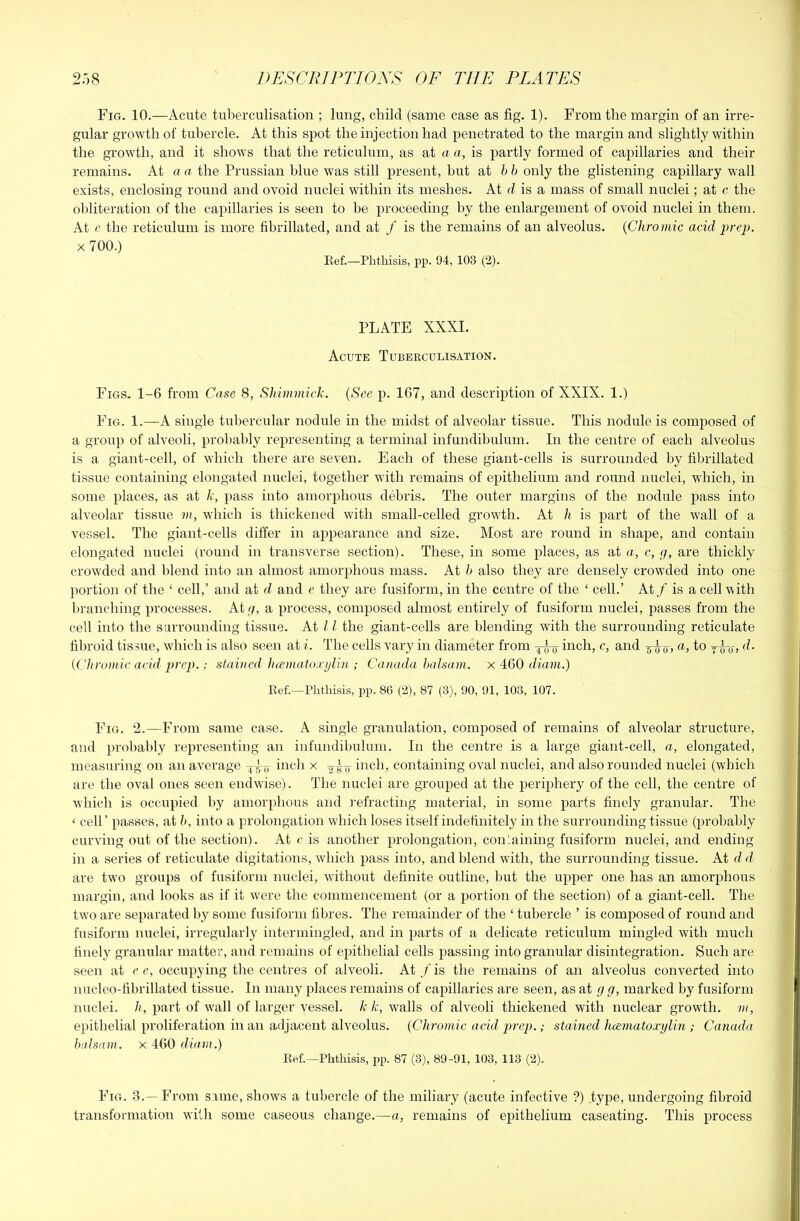 Fig. 10.—Acute tuberculisation ; lung, child (same case as fig. 1). From the margin of an irre- gular growth of tubercle. At this spot the injection had penetrated to the margin and slightly within the growth, and it shows that the reticulum, as at a a, is partly formed of capillaries and their remains. At a a the Prussian blue was still present, but hh only the glistening capillary wall exists, enclosing round and ovoid nuclei within its meshes. At d is a mass of small nuclei; at c the obliteration of the capillaries is seen to be proceeding by the enlargement of ovoid nuclei in them. At c the reticulum is more fibrillated, and at / is the remains of an alveolus. {Chromic acid prep. X 700.) Eef.—Phthisis, pp. 94, 103 (2). PLATE XXXI. Acute Tuberculisation. Figs. 1-6 from Case 8, Shimmick. {See p. 167, and description of XXIX. 1.) Fig. 1.—A single tubercular nodule in the midst of alveolar tissue. This nodule is composed of a group of alveoli, probably representing a terminal infundibulum. In the centre of each alveolus is a giant-cell, of which there are seven. Each of these giant-cells is surrounded by fibrillated tissue containing elongated nuclei, together with remains of epithelium and round nuclei, which, in some places, as at k, pass into amorphous debris. The outer margins of the nodule pass into alveolar tissue m, which is thickened with small-celled growth. At h is part of the wall of a vessel. The giant-cells differ in appearance and size. Most are round in shape, and contain elongated nuclei (round in transverse section). These, in some places, as at a, c, g, are thickly crowded and l)lend into an almost amorphous mass. At h also they are densely crowded into one portion of the ‘ cell,’ and at d and e they are fusiform, in the centre of the ‘ cell.’ At / is a cell with liranching processes. At y, a process, composed almost entirely of fusiform nuclei, jjasses from the cell into the surrounding tissue. At 11 the giant-cells are blending with the surrounding reticulate filiroid tissue, wdiich is also seen at i. The cells vary in diameter from inch, c, and a, to yTo) {CJiromic acid prep.; stained lucmatoxylin ; Canada balsam, x 460 diam.) Ref.—Phthisis, pp. 80 (2), 87 (3), 90, 91, 103, 107. Fig. 2.—From same case. A single granulation, composed of remains of alveolar structure, and probal)ly representing an infundibulum. In the centre is a large giant-cell, a, elongated, measuring on an average inch x inch, containing oval nuclei, and also rounded nuclei (which are the oval ones seen endw'ise). The nuclei are grouped at the periphery of the cell, the centre of which is occupied by amorphous and refracting material, in some parts finely granular. The ‘ cell’ passes, at h, into a prolongation which loses itself indefinitely in the surrounding tissue (probably curving out of the section). At c is another prolongation, containing fusiform nuclei, and ending in a series of reticulate digitations, which pass into, and blend with, the surrounding tissue. At d d are tw'O groups of fusiform nuclei, without definite outline, but the upper one has an amorphous margin, and looks as if it w'ere the commencement (or a portion of the section) of a giant-cell. The two are separated by some fusiform fibres. The remainder of the ‘ tubercle ’ is composed of round and fusiform nuclei, irregularly intermingled, and in parts of a delicate reticulum mingled with much finely granular matter, and remains of epithelial cells passing into granular disintegration. Such are seen at c c, occupying the centres of alveoli. At ./’is the remains of an alveolus converted into nucleo-fibrillated tissue. In many places remains of capillaries are seen, as at g g, marked by fusiform nuclei, h, part of w'all of larger vessel, k k, walls of alveoli thickened with nuclear growth, m, epithelial proliferation in an adjacent alveolus. {Chromic acid prep.; stained hcematoxylin ; Canada balsam, x 460 diani.) Eef.—Phthisis, pp. 87 (3), 89-91, 103, 113 (2). Fig. 3.—From same, show^s a tubercle of the miliary (acute infective ?) type, undergoing fibroid transformation with some caseous change.—a, remains of eiiithelium caseating. This process