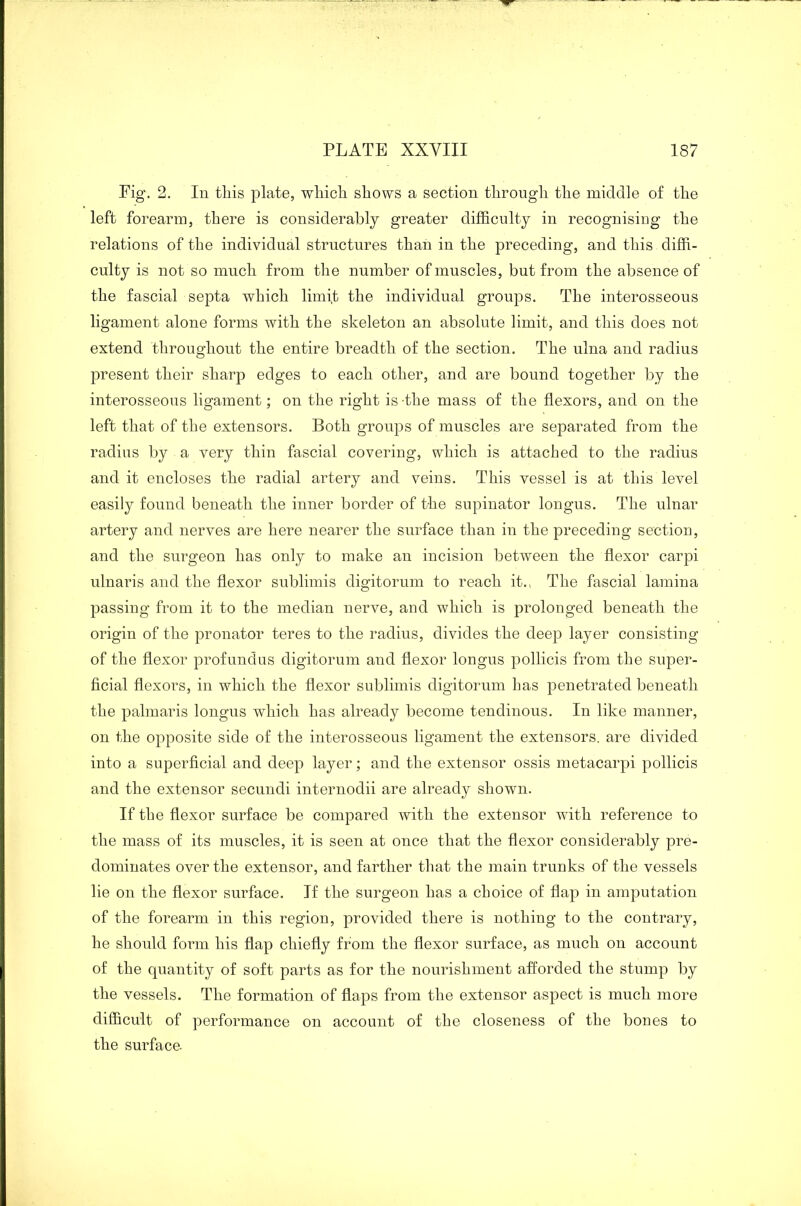 Pig. 2. In this plate, which shows a section through the middle of the left forearm, there is considerably greater difficulty in recognising the relations of the individual structures than in the preceding, and this diffi- culty is not so much from the number of muscles, but from the absence of the fascial septa which limit the individual groups. The interosseous ligament alone forms with the skeleton an absolute limit, and this does not extend throughout the entire breadth of the section. The ulna and radius present their sharp edges to each other, and are bound together by the interosseous ligament; on the right is -the mass of the flexors, and on the left that of the extensors. Both groups of muscles are separated from the radius by a very thin fascial covering, which is attached to the radius and it encloses the radial artery and veins. This vessel is at this level easily found beneath the inner border of the supinator longus. The ulnar artery and nerves are here nearer the surface than in the preceding section, and the surgeon has only to make an incision between the flexor carpi ulnaris and the flexor sublimis digitorum to reach it., The fascial lamina passing from it to the median nerve, and which is prolonged beneath the origin of the pronator teres to the radius, divides the deep layer consisting of the flexor profundus digitorum and flexor longus pollicis from the super- ficial flexors, in which the flexor sublimis digitorum has penetrated beneath the palmaris longus which has already become tendinous. In like manner, on the opposite side of the interosseous ligament the extensors, are divided into a superficial and deep layer; and the extensor ossis metacarpi pollicis and the extensor secundi internodii are already shown. If the flexor surface be compared with the extensor with reference to the mass of its muscles, it is seen at once that the flexor considerably pre- dominates over the extensor, and farther that the main trunks of the vessels lie on the flexor surface. If the surgeon has a choice of flap in amputation of the forearm in this region, provided there is nothing to the contrary, he should form his flap chiefly from the flexor surface, as much on account of the quantity of soft parts as for the nourishment afforded the stump by the vessels. The formation of flaps from the extensor aspect is much more difficult of performance on account of the closeness of the bones to the surface-