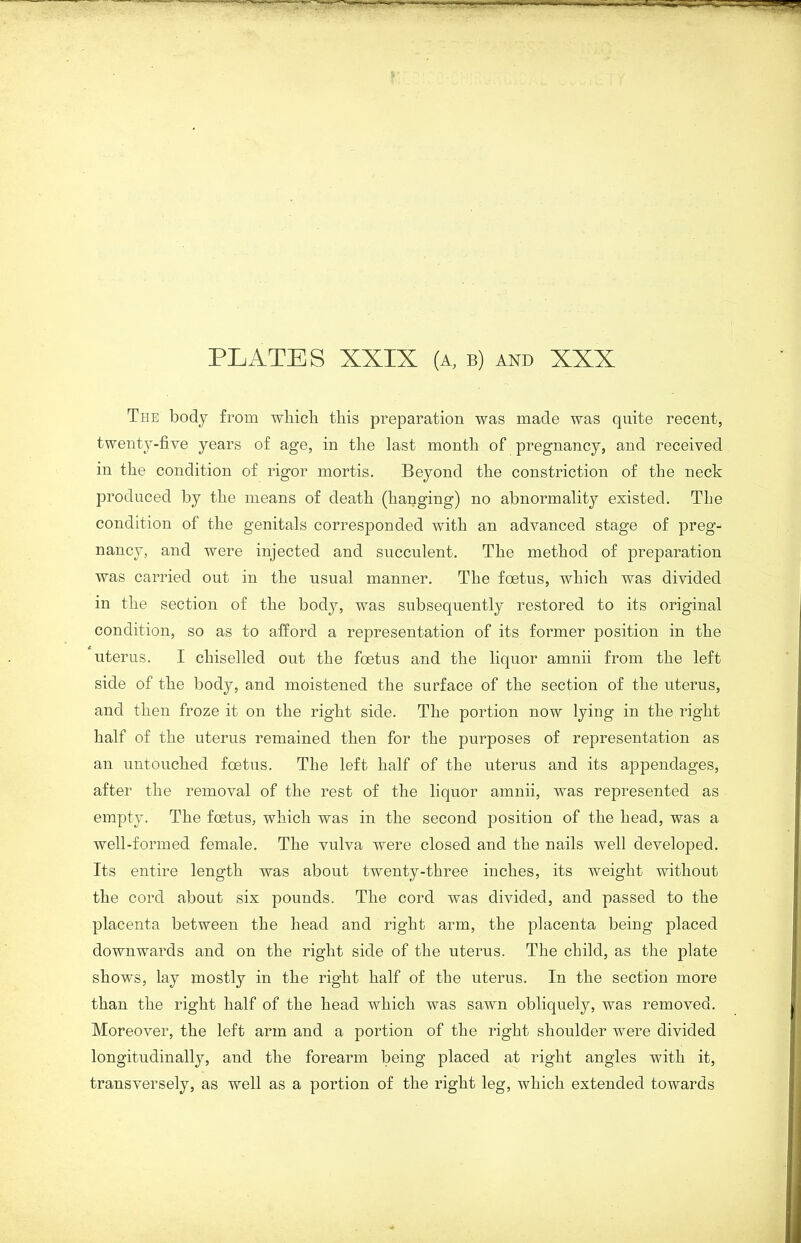 The body from which this preparation was made was quite recent, twenty-five years of age, in the last month of pregnancy, and received in the condition of rigor mortis. Beyond the constriction of the neck produced by the means of death (hanging) no abnormality existed. The condition of the genitals corresponded with an advanced stage of preg- nancy, and were injected and succulent. The method of preparation was carried out in the usual manner. The foetus, which was divided in the section of the body, was subsequently restored to its original condition, so as to afford a representation of its former position in the uterus. I chiselled out the foetus and the liquor amnii from the left side of the body, and moistened the surface of the section of the uterus, and then froze it on the right side. The portion now lying in the right half of the uterus remained then for the purposes of representation as an untouched foetus. The left half of the uterus and its appendages, after the removal of the rest of the liquor amnii, was represented as empty. The foetus, which was in the second position of the head, was a well-formed female. The vulva were closed and the nails well developed. Its entire length was about twenty-three inches, its weight without the cord about six pounds. The cord was divided, and passed to the placenta between the head and right arm, the placenta being placed downwards and on the right side of the uterus. The child, as the plate shows, lay mostly in the right half of the uterus. In the section more than the right half of the head which was sawn obliquely, was removed. Moreover, the left arm and a portion of the right shoulder were divided longitudinally, and the forearm being placed at right angles with it, transversely, as well as a portion of the right leg, which extended towards