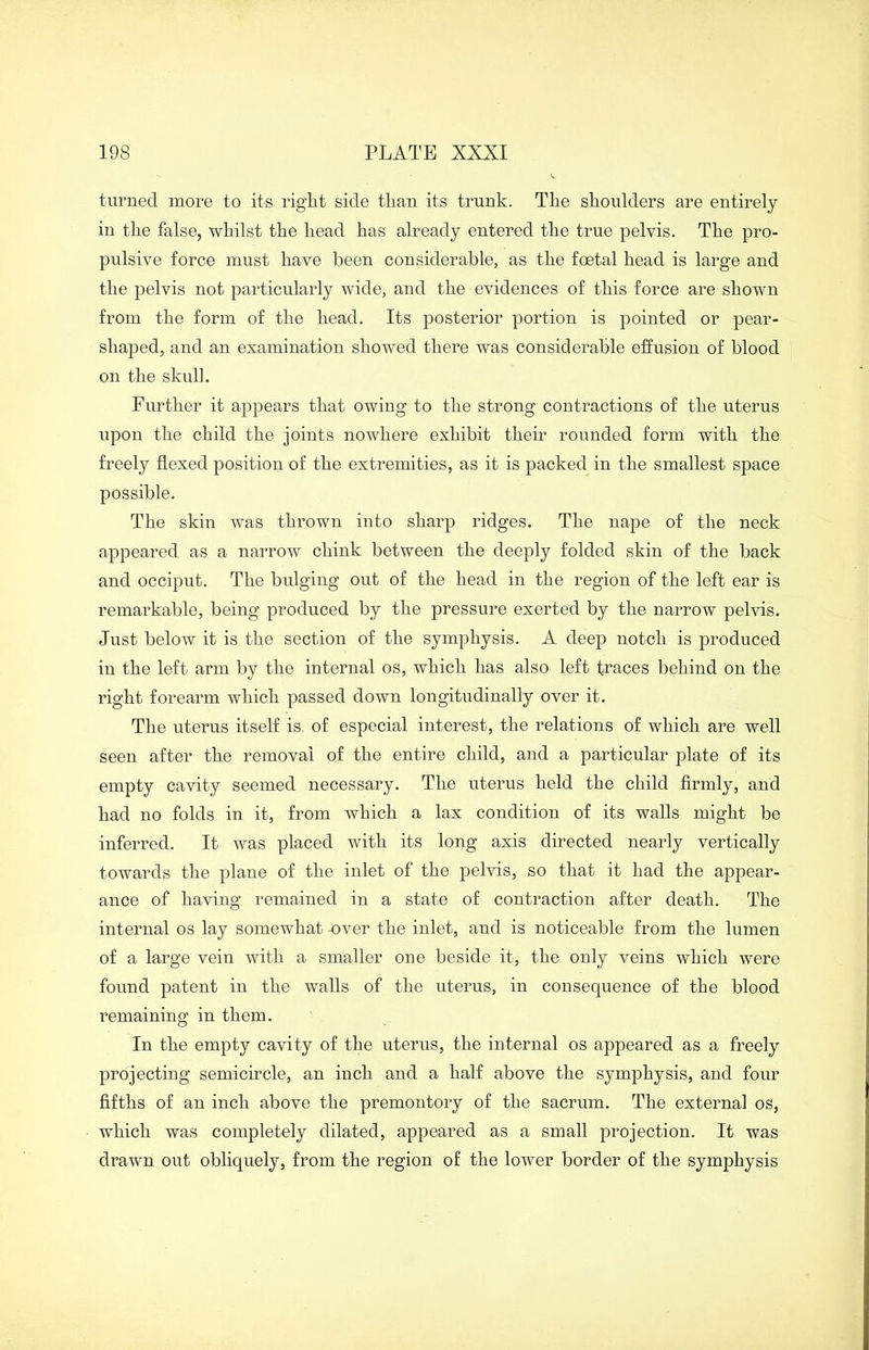 turned more to its right side than its trunk. The shoulders are entirely in the false, whilst the head has already entered the true pelvis. The pro- pulsive force must have been considerable, as the foetal head is large and the pelvis not particularly wide, and the evidences of this force are shown from the form of the head. Its posterior portion is pointed or pear- shaped, and an examination showed there was considerable effusion of blood on the skull. Further it appears that owing to the strong contractions of the uterus upon the child the joints nowhere exhibit their rounded form with the freely flexed position of the extremities, as it is packed in the smallest space possible. The skin was thrown into sharp ridges. The nape of the neck appeared as a narrow chink between the deeply folded skin of the back and occiput. The bulging out of the head in the region of the left ear is remarkable, being produced by the pressure exerted by the narrow pelvis. Just below it is the section of the symphysis. A deep notch is produced in the left arm by the internal os, which has also left traces behind on the right forearm which passed down longitudinally over it. The uterus itself is. of especial interest, the relations of which are well seen after the removal of the entire child, and a particular plate of its empty cavity seemed necessary. The uterus held the child firmly, and had no folds in it, from which a lax condition of its walls might be inferred. It was placed with its long axis directed nearly vertically towards the plane of the inlet of the pelvis, so that it had the appear- ance of having remained in a state of contraction after death. The internal os lay somewhat -over the inlet, and is noticeable from the lumen of a large vein with a smaller one beside it, the only veins which were found patent in the walls of the uterus, in consequence of the blood remaining in them. In the empty cavity of the uterus, the internal os appeared as a freely projecting semicircle, an inch and a half above the symphysis, and four fifths of an inch above the premontory of the sacrum. The external os, which was completely dilated, appeared as a small projection. It was drawn out obliquely, from the region of the lower border of the symphysis