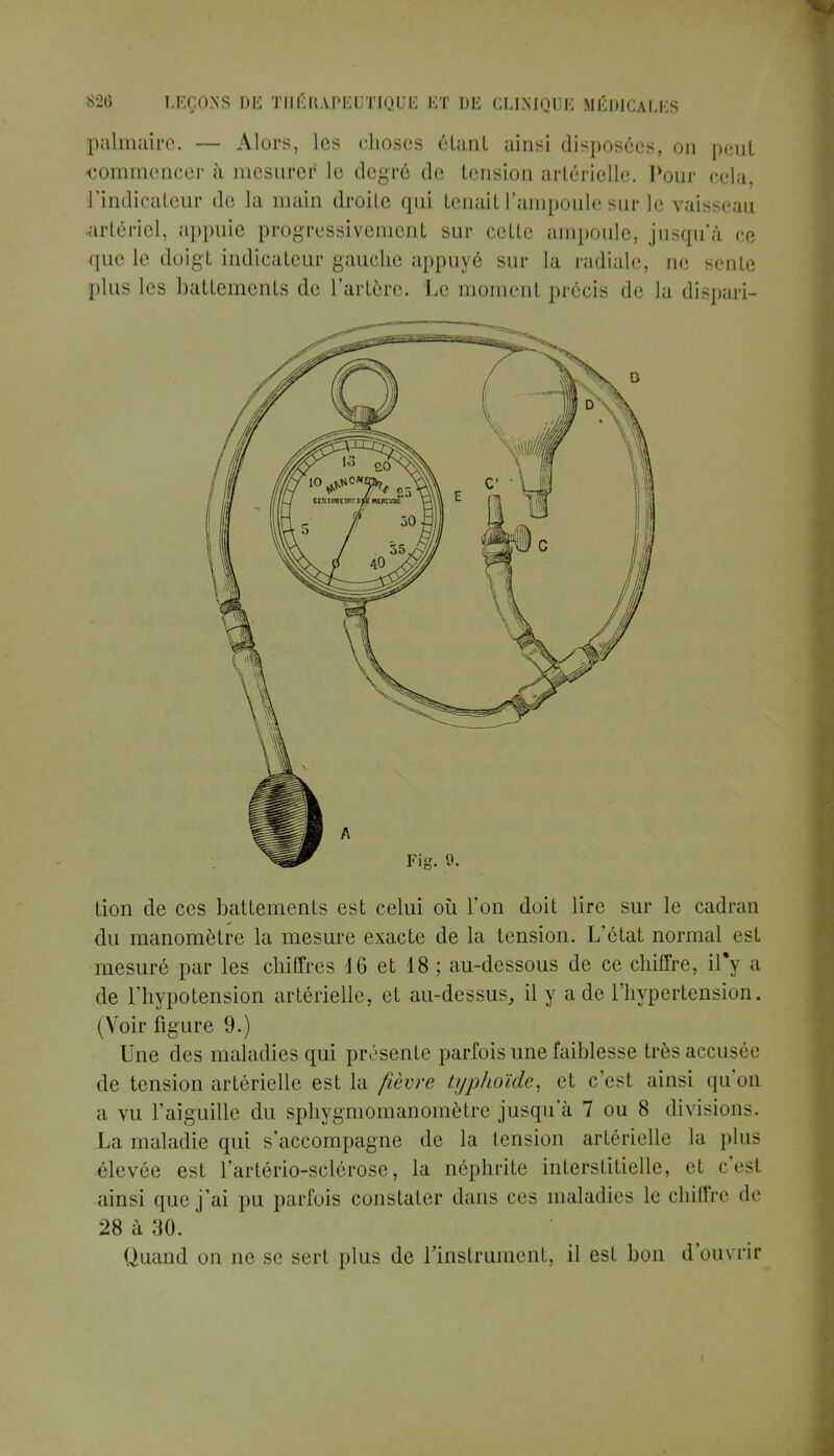 palmaire, — Alors, les choses étant ainsi disposées, on peut commencer à mesurer le degré de tension artérielle. Pour cela l'indicateur de la main droite qui tenait l'ampoule sur le vaisseau artériel, appuie progressivement sur cette ampoule, jusqu'à ce que le doigt indicateur gauche appuyé sur la radiale, ne sente plus les battements de l'artère. Le moment précis de la dispari- tion de ces battements est celui où l'on doit lire sur le cadran du manomètre la mesure exacte de la tension. L'état normal est mesuré par les chiffres 16 et 18 ; au-dessous de ce chiffre, il*y a de l'hypotension artérielle, et au-dessus, il y a de l'hypertension. ( Voir figure 9.) Une des maladies qui présente parfois une faiblesse très accusée de tension artérielle est la fièvre typhoïde, et c'est ainsi qu'on a vu l'aiguille du sphygmomanomètre jusqu'à 7 ou 8 divisions. La maladie qui s'accompagne de la tension artérielle la plus élevée est l'artério-sclérosc, la néphrite interstitielle, el c'esl ainsi que j'ai pu parfois constater dans ces maladies le chiffre de 28 à 30. Quand on ne se sert plus de l'instrument, il est bon d'ouvrir