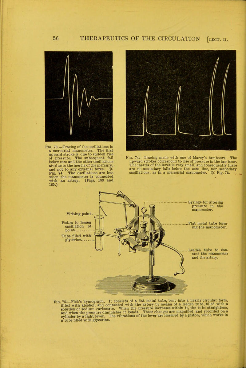 Fio. 73.—Tracing of the oscillations in a mercurial manometer. The first upward stroke is due to sudden rise of pressure. The subsequent fall below zero and the other oscillations are due to the inertia of the mercury, and not to any external force. Cf. Fig. 74. The oscillations are less when the manometer is connected with an artery. (Figs, 183 and 185.) Fig. 74.—Tracing made with one of Marey's tambours. The upward strokes correspond to rise of pressure in the tambour. The inertia of the lever is very small, and consequently there are no secondary falls below the zero line, nor secondary oscillations, as in a mercurial manometer. Cf. Fig. 78. Writing point — Piston to lessen oscillation of point Tube filled with glycerine Syringe for altering pressure in the manometer. Flat metal tube form- ing the manometer. Leaden tube to con- nect the manometer and the artery. Fio 75 —Fick's kymograph. It consists of a flat metal tube, bent into a nearly circular form, 'filled with alcohol, and connected with the artery by means of a leaden tube, filled with a solution of sodium carbonate. Wlien the pressure increases within it, the tube straightens, and when the pressure diminishes it bends. These changes are magnified, and recorded on a cylinder by a light lever. The vibrations of the lever are lessened by a piston, which works in a tube filled with glycerine.