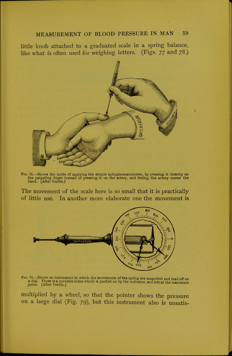 little knob attached to a graduated scale in a spring balance, like what is often used for weighing letters. (Figs. 77 and 78.) Fia. 78.—Shows the mode of applying the simple sphygmomanometer, by pressing it directly on the palpating finger instead of pressing it on the artery, and feeling the artery nearer the hand. (After Verdin.) The movement of the scale here is so small that it is practically of little use. In another more elaborate one the movement is Fig. 79.—Shows an instrument in which the movements of the spring are magnified and read off on a dial. There is a movable index which is pushed on by the indicator, and left at the maximum point. (After Verdin.) multiplied by a wheel, so that the pointer shows the pressure on a large dial (Fig. 79), but this instrument also is unsatis-