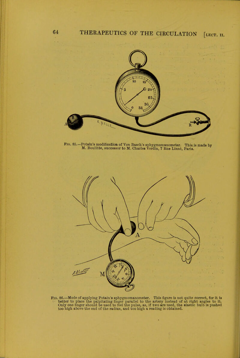 FiQ. 85.—Potain's modification of Von Basch's sphygmomanometer. This is made by M. Boulitte, successor to M. Charles Verdin, 7 Rue Linn6, Paris. Fia. 86.—Mode of applying Potain's sphygmomanometer. This figure is not quite correct, for it Is I better to place the palpitating finger parallel to the artery instead of at right angles to it. Only one finger should be used to feel the pulse, as, if two are used, the elastic bulb is pushed too high above the end of the radius, and too high a reading is obtained.