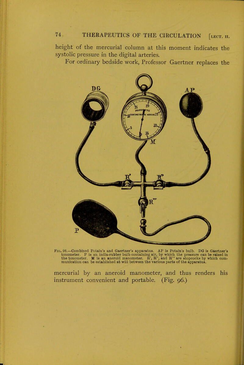 height of the mercurial column at this moment indicates the systolic pressure in the digital arteries. For ordinary bedside work, Professor Gaertner replaces the Fig. 98.—CombiDed Potain's and Gaertner's apparatus. AP is Potain's bulb. DG is Gaertner's tonometer. P is an india-rubber bulb containing air, by which the pressure can be raised in the tonometer. M is an aneroid manometer. R', R, and R' are stopcocks by which com- munication can be established at will between the various parts of the apparatus. mercurial by an aneroid manometer, and thus renders his instrument convenient and portable. (Fig. 96.)