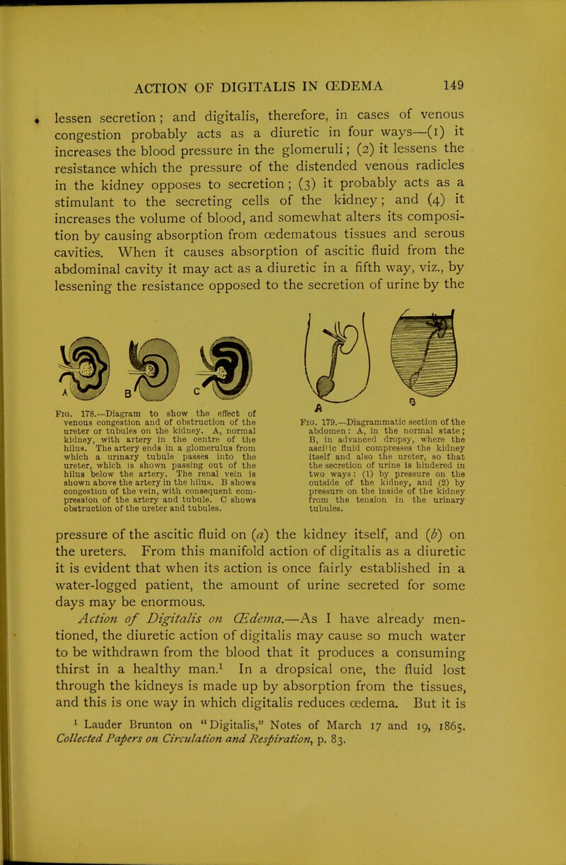 lessen secretion; and digitalis, therefore, in cases of venous congestion probably acts as a diuretic in four ways—(i) it increases the blood pressure in the glomeruli; (2) it lessens the resistance which the pressure of the distended venous radicles in the kidney opposes to secretion; (3) it probably acts as a stimulant to the secreting cells of the kidney; and (4) it increases the volume of blood, and somewhat alters its composi- tion by causing absorption from oedematous tissues and serous cavities. When it causes absorption of ascitic fluid from the abdominal cavity it may act as a diuretic in a fifth way, viz., by lessening the resistance opposed to the secretion of urine by the pressure of the ascitic fluid on {a) the kidney itself, and {b) on the ureters. From this manifold action of digitalis as a diuretic it is evident that when its action is once fairly established in a water-logged patient, the amount of urine secreted for some days may be enormous. Action of Digitalis on (Edema.—As I have already men- tioned, the diuretic action of digitalis may cause so much water to be withdrawn from the blood that it produces a consuming thirst in a healthy man.^ In a dropsical one, the fluid lost through the kidneys is made up by absorption from the tissues, and this is one way in which digitalis reduces oedema. But it is ^ Lauder Brunton on Digitalis, Notes of March 17 and 19, 1865. Collected Pampers on Circulation and Respiration^ p. 83. Fig. 178.—Diagram to show the effect of venous congestion and of obstruction of the ureter or tubules on the kidney. A, normal kidney, with artery in the centre of the hilus. The artery ends in a glomerulus from which a urinary tubule passes into the ureter, which is shown passing out of the hilus below the artery. The renal vein is shown above the artery in the hilus. B shows congestion of the vein, with consequent com- pression of the artery and tubule. C shows obstruction of the ureter and tubules. Fig. 179.—^Diagrammatic section of the abdomen : A, in the normal state; B, in advanced dropsy, where the ascitic fluid compresses the kidney itself and also the ureter, so that the secretion of urine is hindered in two ways: (1) by pressure on the outside of the kidney, and (2) by pressure on the inside of the kidney from the tension in the urinary tubules.