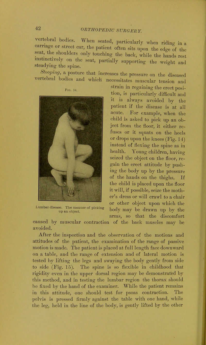 nin iloPEDIC SURGERY. Fig. 14. vertebral bodies. When seated, particularly when riding in a carnage or street car, the patient often sits upon the edge of the seat, the shoulders only touching the back, while the hands rest instinctively on the seat, partially supporting the weight and steadying the spine. Stooping, a posture that increases the pressure on the diseased vertebral bodies and which necessitates muscular tension and strain in regaining the erect posi- tion, is particularly difficult and it is always avoided by the patient if the disease is at all acute. For example, when the child is asked to pick up an ob- ject from the floor, it either re- fuses or it squats on the heels or drops upon the knees (Fig. 14) instead of flexing the spine as in health. Young children, having seized the object on the floor, re- gain the erect attitude by push- ing the body up by the pressure of the hands on the thighs. If the child is placed upon the floor it will, if possible, seize the moth- er's dress or will crawl to a chair or other object upon which the body may be drawn up by the arms, so that the discomfort caused by muscular contraction of the back muscles may be avoided. After the inspection and the observation of the motions and attitudes of the patient, the examination of the range of passive motion is made. The patient is placed at full length face downward on a table, and the range of extension and of lateral motion is tested by lifting the legs and swaying the body gently from side to side (Fig. 15). The spine is so flexible in childhood that rigidity even in the upper dorsal region may be demonstrated by this method, and in testing the lumbar region the thorax should be fixed by the hand of the examiner. While the patient remains in this attitude, one should test for psoas contraction. The pelvis is pressed firmly against the table with one hand, while the leg, held in the line of the body, is gently lifted by the other Lumbar disease. The mauner of picking up au object.