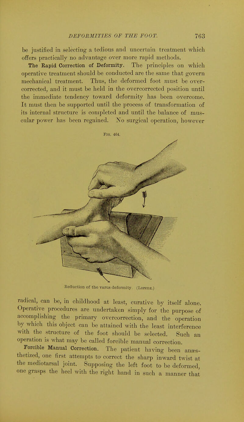 be justified in selecting a tedious and uncertain treatment which offers pi'actically no advantage over more rapid methods. The Rapid Correction of Deformity. The principles on which operative treatment should be conducted are the same that govern mechanical treatment. Thus, the deformed foot must be over- corrected, and it must be held in the overcorrected position until the immediate tendency toward deformity has been overcome. It must then be supported until the process of transformation of its internal structure is completed and until the balance of mus- cular power has been regained. No surgical operation, however Fig. 464. Reduction of the varus deformity. (Lorenz.) radical, can be, in childhood at least, curative by itself alone. Operative procedures are undertaken simply for the purpose of accomplishing the primary overcorrection, and the operation by which this object can be attained with the least interference with the structure of the foot should be selected. Such an operation is what may be called forcible manual correction. Forcible Manual Correction. The patient having been anes- thetized, one first attempts to- correct the sharp inward twist at the mediotarsal joint. Supposing the left foot to be deformed one grasps the heel with the right hand in such a manner that