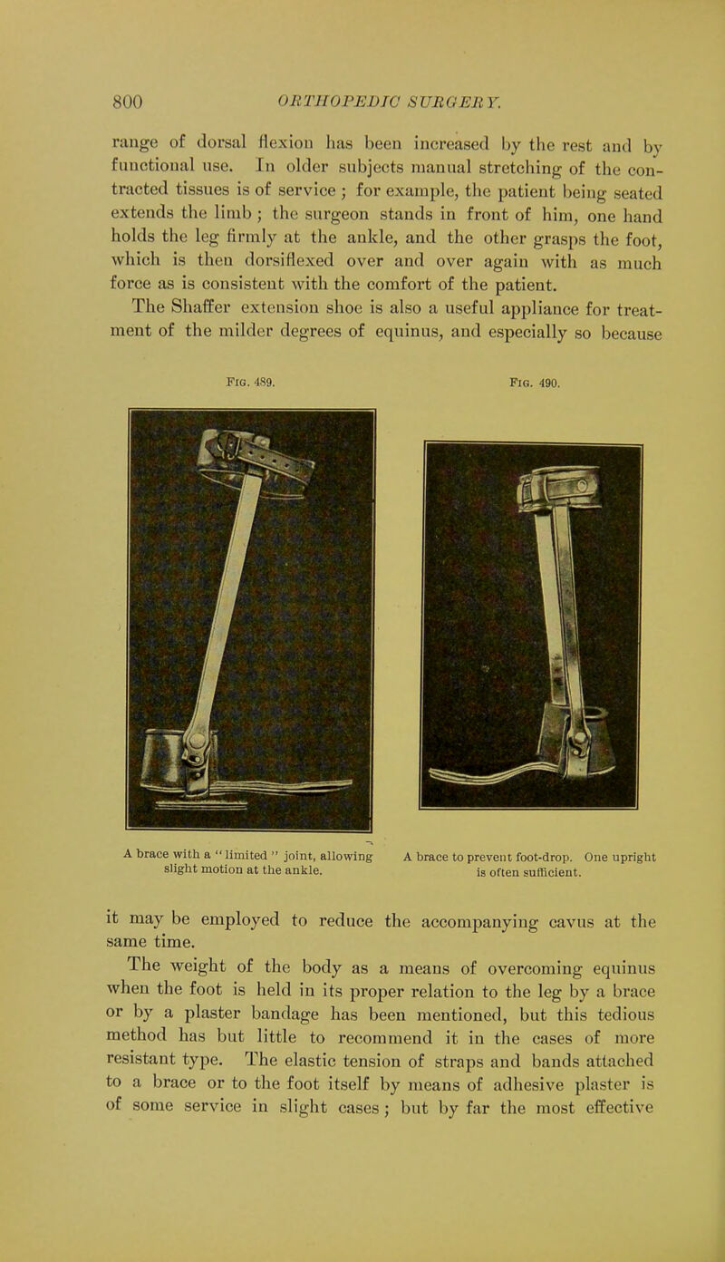 range of dorsal flexion has been increased by the rest and by functional use. In older subjects manual stretching of the con- tracted tissues is of service ; for example, the patient being seated extends the limb ; the surgeon stands in front of him, one hand holds the leg firmly at the ankle, and the other grasps the foot, which is then dorsiflexed over and over again with as much force as is consistent with the comfort of the patient. The Shaffer extension shoe is also a useful appliance for treat- ment of the milder degrees of equinus, and especially so because Fig. 489. Pig. 490. A brace with a  limited  joint, allowing A brace to prevent foot-drop. One upright slight motion at the ankle. is often sufficient. it may be employed to reduce the accompanying cavus at the same time. The weight of the body as a means of overcoming equinus when the foot is held in its proper relation to the leg by a brace or by a plaster bandage has been mentioned, but this tedious method has but little to recommend it in the cases of mure resistant type. The elastic tension of straps and bands attached to a brace or to the foot itself by means of adhesive plaster is of some service in slight cases ; but by far the most effective