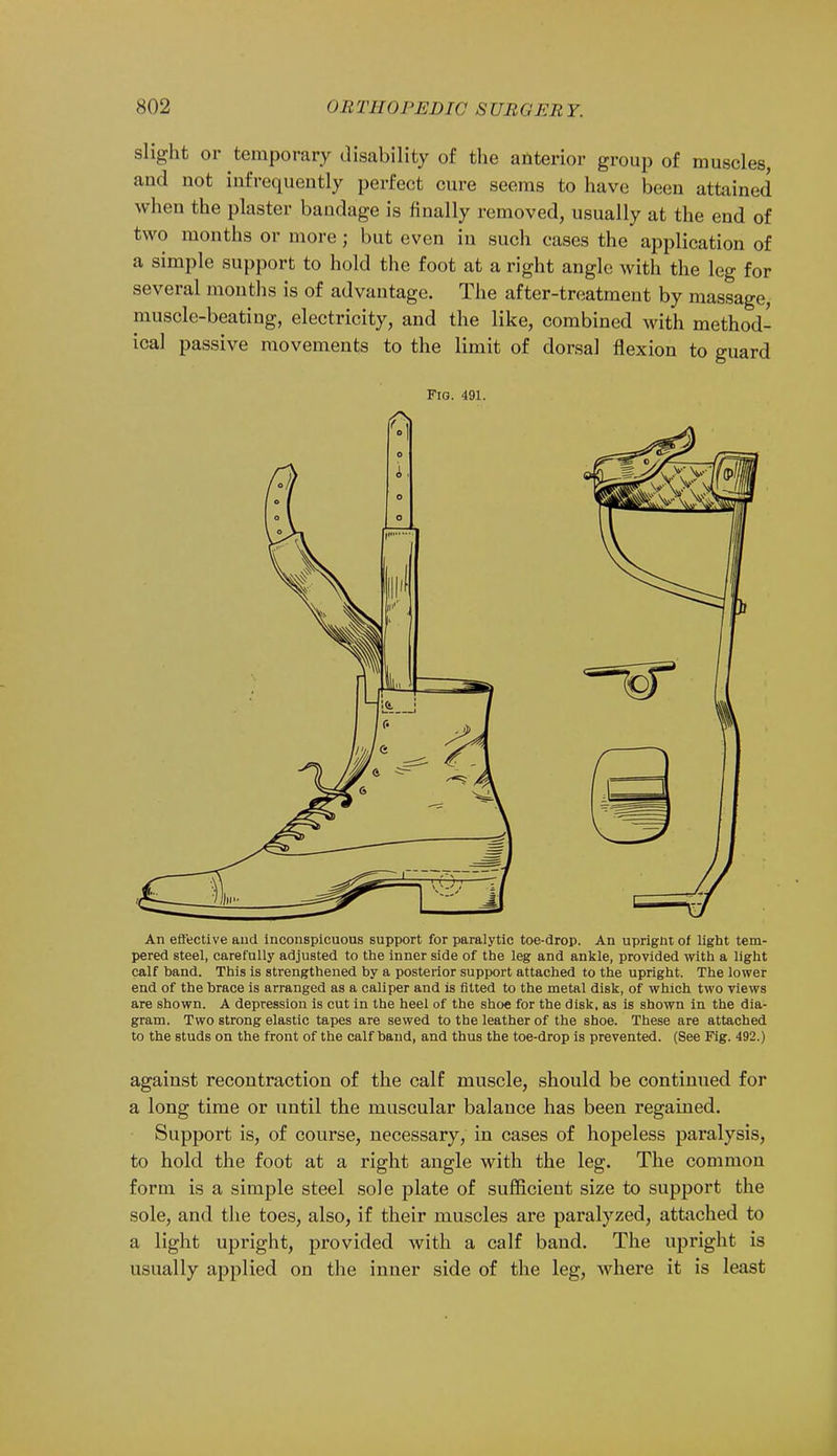 slight or temporary disability of the anterior group of muscles, and not infrequently perfect cure seems to have been attained when the plaster bandage is finally removed, usually at the end of two months or more; but even in such cases the application of a simple support to hold the foot at a right angle with the leg for several months is of advantage. The after-treatment by massage, muscle-beating, electricity, and the like, combined with method- ical passive movements to the limit of dorsal flexion to guard Fig. 491. An effective and inconspicuous support for paralytic toe-drop. An uprignt of light tem- pered steel, carefully adjusted to the inner side of the leg and ankle, provided with a light calf band. This is strengthened by a posterior support attached to the upright. The lower end of the brace is arranged as a caliper and is fitted to the metal disk, of which two views are shown. A depression is cut in the heel of the shoe for the disk, as is shown in the dia- gram. Two strong elastic tapes are sewed to the leather of the shoe. These are attached to the studs on the front of the calf band, and thus the toe-drop is prevented. (See Fig. 492.) against recontraction of the calf muscle, should be continued for a long time or until the muscular balance has been regained. Support is, of course, necessary, in cases of hopeless paralysis, to hold the foot at a right angle with the leg. The common form is a simple steel sole plate of sufficient size to support the sole, and the toes, also, if their muscles are paralyzed, attached to a light upright, provided with a calf band. The upright is usually applied on the inner side of the leg, where it is least