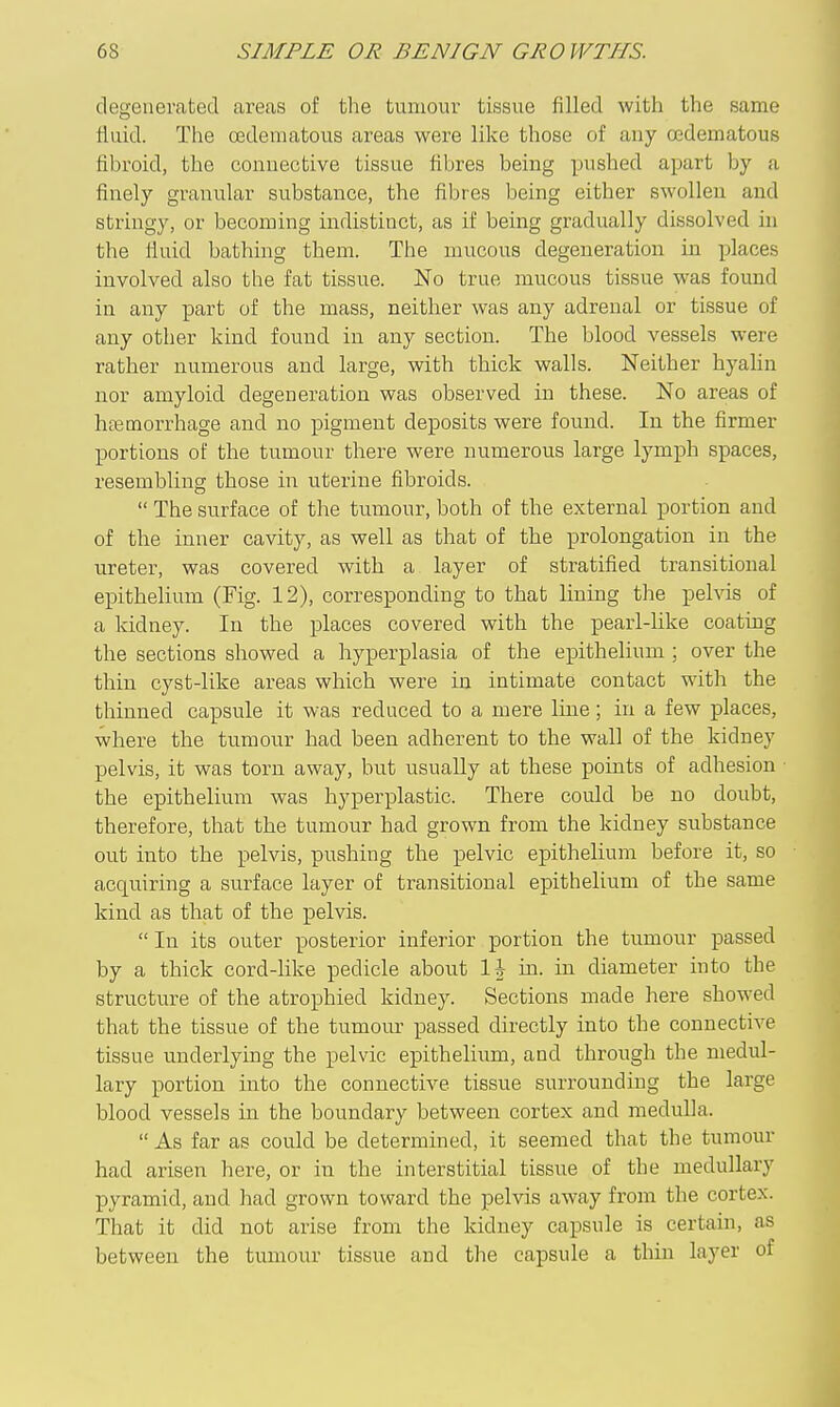 degenerated areas of tlie tumour tissue filled with the same fluid. The oedematous areas were like those of any oedematous fibroid, the connective tissue fibres being pushed apart by a finely granular substance, the fibres being either swollen and stringy, or becoming indistinct, as if being gradually dissolved iii the fluid bathing them. The mucous degeneration in places involved also the fat tissue. No true mucous tissue was found in any part of the mass, neither was any adrenal or tissue of any other kind found in any section. The blood vessels were rather numerous and large, with thick walls. Neither hyalin nor amyloid degeneration was observed in these. No areas of hfEcnorrhage and no pigment deposits were found. In the firmer portions of the tumour there were numerous large lymph spaces, resembling those in uterine fibroids.  The surface of the tumour, both of the external portion and of the inner cavity, as well as that of the prolongation in the ureter, was covered with a layer of stratified transitional epithelium (Fig. 12), corresponding to that lining the pelvis of a kidney. In the places covered with the pearl-like coating the sections showed a hyperplasia of the epithelium ; over the thin cyst-like areas which were in intimate contact with the thinned capsule it was reduced to a mere Ime; in a few places, where the tumour had been adherent to the wall of the kidney pelvis, it was torn away, but usually at these points of adhesion the epithelium was hyperplastic. There could be no doubt, therefore, that the tumour had grown from the kidney substance out into the pelvis, pushing the pelvic epithelium before it, so acquiring a surface layer of transitional epithelium of the same kind as that of the pelvis. In its outer posterior inferior portion the tumour passed by a thick cord-like pedicle about \\ in. in diameter into the structure of the atrophied kidney. Sections made here showed that the tissue of the tumom- passed directly into the connective tissue underlying the pelvic epithelium, and through the medul- lary portion into the connective tissue surrounding the large blood vessels in the boundary between cortex and medulla.  As far as could be determined, it seemed that the tumour had arisen here, or in the interstitial tissue of the medullary pyramid, and had grown toward the pelvis away from the cortex. That it did not arise from the kidney capsule is certain, as between the tumour tissue and the capsule a thin layer of
