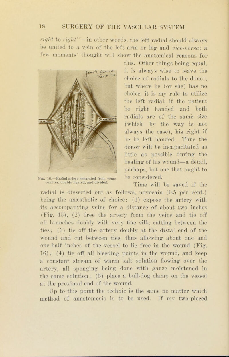 rig]it to rifjhf'—'m other words, tlie left radial should always be united to a vein of the left arm or leg- and vice-versa; a few moments' thought will show the anatomical reasons for radial is dissected out as follows, novocain (0.5 ]WY cent.) being the ana:'sthetic of choice: (1) expose the artery with its accompanying veins for a distance of about two inches (Fig. 15), (2) free the artery from the veins and tie off all branches doubly with very fine silk, cutting between the ties; (3) tie off the artery doubly at the distal end of the wound and cut between ties, thus allowing about one and one-half inches of the vessel to lie free in the wound (Fig. 16) ; (4) tie off all bleeding points in the wound, and keep a constant stream of warm salt solution flowing over the artery, all sponging being done with gauze moistened in the same solution; (5) place a bull-dog clamp on the vessel at the proximal end of the wound. Up to this point the technic is the same no matter which method of anastomosis is to be used. If my two-y^ieced Fig. 16.—Radial artery separated from venae ooinites, doubly ligated, and divided. 1 this. Other things being equal, it is always wise to leave the choice of radials to the donor, but where he (or she) has no choice, it is my rule to utilize the left radial, if the ])atient be right handed and both radials are of the same size (which bv the wav is not always the case), his right if he be left handed. Thus the donor will be incapacitated as little as possilile during the healing of his wound—a detail, perhaps, l)ut one that ought to be considered. Time will he saved if the