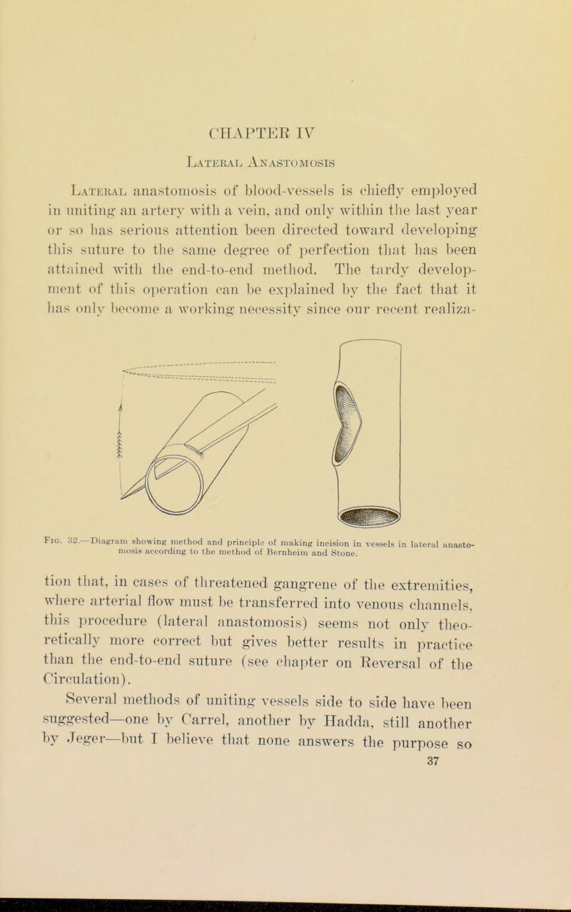 CHAPTER IV Lateeai., Anastomosis Lateral anastomosis of blood-vessels is chiefly emi3loyed ill uniting an artery witli a vein, and only witliin the last year or so has serions attention been directed toward developing this suture to the same degree of perfection that has been attained witli the end-to-end method. The tardy develop- ment of this operation can be explained by the fact that it has only become a working; necessity since our recent realiza- FiG. .32.—Diagram showing method and principle of making incision in vessels in lateral anasto- mosis according to the method of Bernheim and Stone. tion that, in cases of threatened gangrene of the extremities, where arterial flow must be transferred into venous channels, this procedure (lateral anastomosis) seems not only theo- retically more correct but gives better results in practice than the end-to-end suture (see chapter on Reversal of the Circulation). Several methods of uniting vessels side to side have been suggested—one by Carrel, another by Hadda, still another by Jeger—but I believe that none answers the purpose so