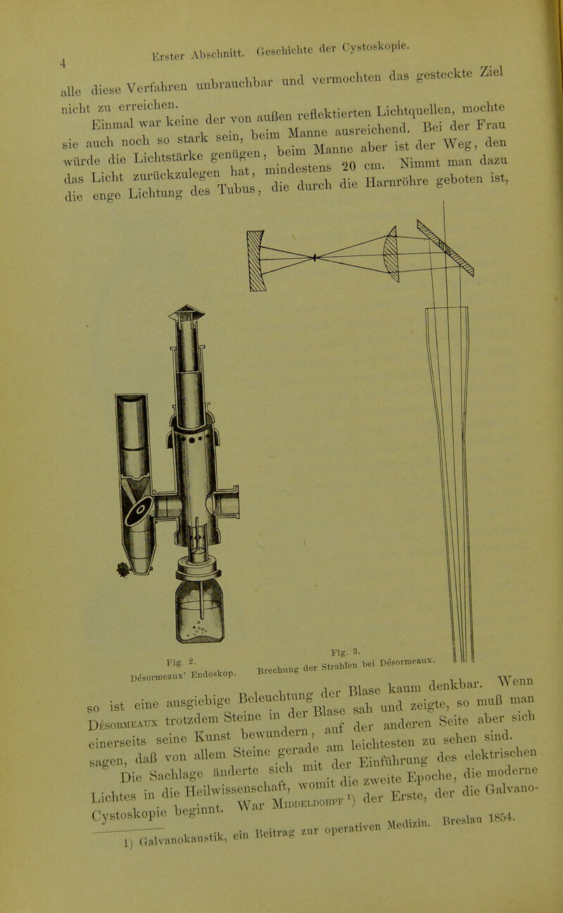 diese Verfahren unbrauchbar und venuoehten das gesteckte Ziel nicht zu erreichen. ^reflektierten Lichtquellen, mochte ^r^'r Xk stirbt* «ei der Frau tÄ::tr.:j.n, b.. Manne - - - Weg.^u t tSÄrXurrrn - Hamr^re geboten ist, Fig. 3. , Endoskop Brechung der Strahlen .ei I>^sor.eaux Dcsormeaux' ünüosKop. Dcsormeaux s^^^^^^^i. i i Wpiin 1 . -RU^p kaum denkbar. v> eun ,0 ist eine ausgiebige Beleuchtung de. Bla e Dfeo«M.*ux trot.demSte.ne - de'Bla e sal ^^^^ einerseits seine Kunst bewundern au^ ^ sagen, daß von f .«f Ter Einführung des elektr.schen Die Sachlage itnderte s,ch '^j^ ,,,,,te Epoche, die moderne Lichtes in,aieHeilwiss»s.,a^^.^^^^^^^^^^ ^ie Galvano- Cystoskop.e begmnt. Wa. 1854. -^a„oka„»tik. ein Beitra. zur opera,.ve„ Me„.n..