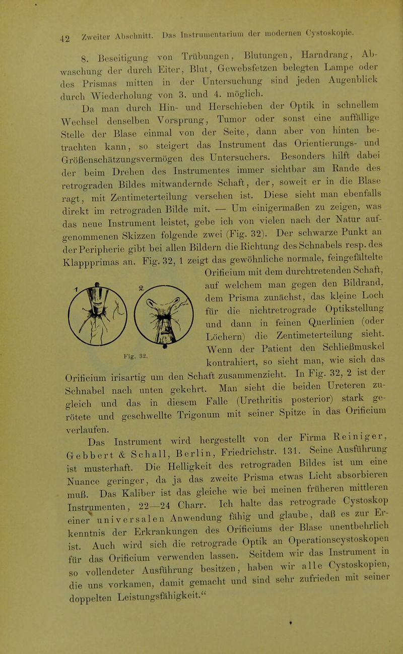 8. Beseitigung von 'ri-übungcn, Blutungen, Harndrang, Ab- waschung- der durch Eiter, Blut, Gewebsfetzen belegten Lampe oder des Prismas mitten in der Untersuchung sind jerlen Augenblick durch Wiederholung von 3. und 4. möglich. Da man durch Hin- und Herschieben der Optik in schnellen! Wechsel denselben Vorsprung, Tumor oder sonst eine auffällige Stelle der Blase einmal von der Seite, dann aber von hinten be- trachten kann, so steigert das Instrument das Orientierungs- und Größenschätzungsvermögen des Untersuchers. Besonders hilft dabei der beim Drehen des Instrumentes immer sichtbar am Rande des retrograden Bildes mitwandernde Schaft, der, soweit er in die Blase ragt, mit Zentimeterteilung versehen ist. Diese sieht man ebenfalls direkt im retrograden Bilde mit. — Um einigermaßen zu zeigen, was das neue Instrument leistet, gebe ich von vielen nach der Natur auf- genommenen Skizzen folgende zwei (Fig. 32). Der schwarze Punkt an der Peripherie gibt bei allen Bildern die Richtung des Schnabels resp.des Klappprimas an. Fig. 32, 1 zeigt das gewöhnliche normale, feingefältelte Oriticium mit dem duixhtretenden Schaft, ^ auf welchem man gegen den Bildrand, dem Prisma zunächst, das kleine Loch für die nichtretrograde Optikstellung und dann in feinen Querlinien (oder Löchern) die Zentimeterteilung sieht. Wenn der Patient den Schließmuskel kontrahiert, so sieht man, wie sich das Orificium irisartig um den Schaft zusammenzieht. In Fig. 32, 2 ist der Schnabel nach unten gekehrt. Man sieht die beiden Ureteren zu- gleich und das in diesem Falle (Urethritis posterior) stark ge- rötete und geschwellte Trigonum mit seiner Spitze m das Orificium verlaufen. . . Das Instrument wird hergestellt von der Firma Reiniger, Gebbert & Schall, Berlin, Friedrichstr. 131. Seine Ausführung ist musterhaft. Die Helligkeit des retrograden Bildes ist um eme Nuance geringer, da ja das zweite Prisma etwas Licht absorbieren muß. Das Kaliber ist das gleiche wie bei meinen früheren mittleren Instrumenten, 22-24 Charr. Ich halte das retrograde Cystoskop eine; universalen Anwendung fähig und glaube, daß es zur Er- kenntnis der Erkrankungen des Orificiums der Blase unentbe irlich ist Auch wird sich die retrograde Optik an Operationscystoskopen für das Orificium verwenden lassen. Seitdem wir cias Iiistrument ui so vollendeter Ausführung besitzen, haben wir alle Cystoskopien die uns vorkamen, damit gemacht und sind sehr zufrieden mit semei doppelten Leistungsfähigkeit. «