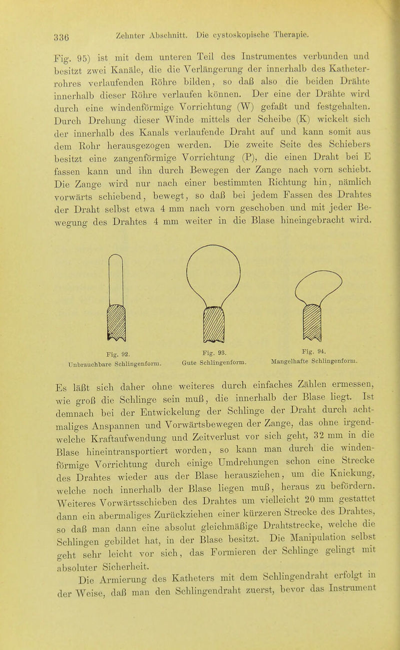 Fig. 95) ist mit dem unteren Teil des Instrumentes verbunden und besitzt zwei Kanäle, die die Verlängerung der innerhalb des Katheter- rohres verlaufenden Röhre bilden, so daß also die beiden Drähte innerhalb dieser Röhre verlaufen können. Der eine der Drähte wird durch eine windenförmige Vorrichtung (W) gefaßt und festgehalten. Durch Drehung dieser Winde mittels der Scheibe (K) wickelt sich der innerhalb des Kanals verlaufende Draht auf und kann somit aus dem Rohr herausgezogen werden. Die zweite Seite des Schiebers besitzt eine zangenförmige Vorrichtung (P), die einen Draht bei E fassen kann und ihn durch Bewegen der Zange nach vorn schiebt. Die Zange wird nur nach einer bestimmten Richtung hin, nämlich vorwärts schiebend, bewegt, so daß bei jedem Fassen des Drahtes der Draht selbst etwa 4 mm nach vorn geschoben und mit jeder Be- wegung des Drahtes 4 mm weiter in die Blase hineingebracht wird. Fig. 92. UnbrauclibaTe Schlingenform. Fig. 93. Gute Schlingenfonn. Fig. 94. Mangelhafte Schlingenform. Es läßt sich daher ohne weiteres durch einfaches Zählen ermessen, wie groß die Schlinge sein muß, die innerhalb der Blase liegt. Ist demnach bei der Entwickelung der Schlinge der Draht durch acht- maliges Anspannen und Vorwärtsbewegen der Zange, das ohne ii'gend- welche Kraftaufwendung und Zeitverlust vor sich geht, 32 mm in die Blase hineintransportiert worden, so kann man dmxh die winden- förmige Vorrichtung durch einige Umdrehungen schon eine Strecke des Drahtes wieder aus der Blase herausziehen, um die Knickung, welche noch innerhalb der Blase liegen muß, heraus zu befördern. Weiteres Vorwärtsschieben des Drahtes um vielleicht 20 mm gestattet dann ein abermaliges Zurückziehen einer kürzeren Strecke des Drahtes, so daß man dann eine absolut gleichmäßige Drahtstrecke, welche die Schlingen gebildet hat, in der Blase besitzt. Die Manipulation selbst o-eht sehr leicht vor sich, das Formieren der Schlinge gehngt mit o absoluter Sicherheit. Die Armierung des Katheters mit dem Schiingendraht erfolgt m der Weise, daß man den Schlingendraht zuerst, bevor das Insti'ument