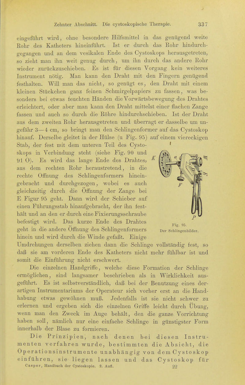 eing-eführt genügend weite Rohr hindurch- wird, ohne besondere Hilfsmittel in das Rohr des Katheters hineinführt. Ist er dui-ch das gegangen und au dem vesilcalen Ende des Cystoskops herausgetreten, so zieht man ihn weit genug diu-ch, um ihn durch das andere Rohr wieder zurückzuschieben. Es ist für diesen Vorgang kein weiteres Instrument nötig. Man kann den Draht mit den Fingern genügend festhalten. WiU man das nicht, so genügt es, den Draht mit einem kleinen Stückchen ganz feinen Schmirgelpapiers zu fassen, was be- sonders bei etwas feuchten Händen die Vorwärtsbewegung des Drahtes erleichtert, oder aber man kann den Draht mittelst einer flachen Zange fassen und auch so durch die Röhre hindurchschieben. Ist der Draht aus dem zweiten Rohr herausgetreten und überragt er dasselbe um un- gefälir 3—4 cm, so bringt man den Schiingenformer auf das Cystoskop hinauf. Derselbe gleitet in der Hülse (u Fig. 95) auf einem viereckigen Stab, der fest mit dem unteren Teil des Cysto- ' skops in Verbindung steht (siehe Fig. 90 und 91 0). Es wird das lange Ende des Drahtes? aus dem rechten Rohr heraustretend, in die rechte Ofinung des Schiingenformers hinein- und durchgezogen, wobei es auch durch die Öffnung der Zange bei Dann wird der Schieber auf einen Führungsstab hinaufgebracht, der ihn fest- gebracht gleichzeitig E Figur 95 geht. hält und an den er durch eine Fixierungsscliraube befestigt Fig. 95. Der ScliUngeubilder. wird. Das kurze Ende des Drahtes geht in die andere Öffnung des Schiingenformers hinein und wird durch die Winde gefaßt. Einige Umdrehungen derselben ziehen dann die Schlinge vollständig fest, so daß sie am vorderen Ende des Katheters nicht mehr fühlbar ist und somit die Einführung nicht erschwert. Die einzelnen Handgriffe, welche diese Formation der Schlinge ermöglichen, sind langsamer beschrieben als in Wirklichkeit aus- gefülirt. Es ist selbstverständlich, daß bei der Benutzung eines der- artigen Instrumentariums der Operateur sich vorher erst an die Hand- habung etwas gewöhnen muß. Jedenfalls ist sie nicht schwer zu erlernen und ergeben sich die einzelnen Griffe leicht durch Übung, wenn man den Zweck im Auge behält, den die ganze Vorrichtung haben soll, nämlich nur eine einfache Schlinge in günstigster Form innerhalb der Blase zu formieren. Die Prinzipien, nach denen bei diesen Instru- menten verfahren wurde, bestimmten die Absicht, die Operationsinstrumente unabhängig von demCystoskop einführen, sie liegen lassen und das Cystoskop für Casper, Handbuch der Oystoskopie. 2. Aufl. 22