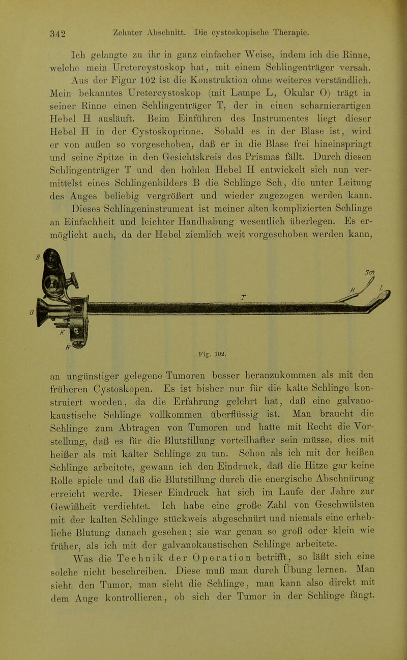 Ich gelangte zi\ ihr in ganz einfacher Weise, indem ich die Rinne, welclic mein Uretercystoskop hat, mit einem SchHngenträger versah. Aus der Figur 102 ist die Konstruktion ohne Aveiteres verständlicli. Mein bekanntes Uretercystoskop (mit Lampe L, Okular 0) trägt in seiner Rinne einen Schiingenträger T, der in einen scharnierartigen Hebel H ausläuft. Beim Einführen des Instrumentes liegt dieser Hebel H in der Cystoskoprinne. Sobald es in der Blase ist, wird er von außen so vorgeschoben, daß er in die Blase frei hineinspringt und seine Spitze in den Gresichtskreis des Prismas fällt. Durch diesen Schiingenträger T und den hohlen Hebel H entwickelt sich nun ver- mittelst eines Schlingenbilders B die Schlinge Sch, die unter Leitung des Auges beliebig vergrößert und wieder zugezogen werden kann. Dieses Schiingeninstrument ist meiner alten komplizierten Schlinge an Einfachheit und leichter Handhabung wesentlich überlegen. Es er- möglicht auch, da der Hebel ziemlich weit vorgeschoben werden kann. 0 Fig. 102. an unsrünstisrer g-elesfene Tumoren besser heranzukommen als mit den frülieren Cystoskopen. Es ist bisher nur füi' die kalte Schlinge kon- struiert worden, da die Erfahrung gelehrt hat, daß eine galvano- kaustische Schlinge vollkommen überflüssig ist. Man braucht die Schlinge zum Abtragen von Tumoren und hatte mit Recht die Vor- stellung, daß es für die Blutstillung vorteilhafter sein müsse, dies mit heißer als mit kalter Schlinge zu tun. Schon als ich mit der heißen Schlinge arbeitete, gewann ich den Eindruck, daß die Hitze gar keine Rolle spiele und daß die Blutstillung durch die energische Abschnürung erreicht werde. Dieser Eindruck hat sich im Laufe der Jahre zur Gewißheit verdichtet. Ich habe eine große Zahl von Geschwülsten mit der kalten Sclflinge stückweis abgeschnürt und niemals eine erheb- liche Blutung danach gesehen; sie war genau so groß oder klein wie früher, als ich mit der galvanokaustischen Schlinge arbeitete. Was die Technik der Operation betrifft, so läßt sich eine solche nicht beschreiben. Diese muß man durch Übung lernen. Man sieht den Tumor, man sieht die Schlinge, man kann also direkt mit dem Auge kontrollieren, ob sich der Tumor in der Schlinge fängt.