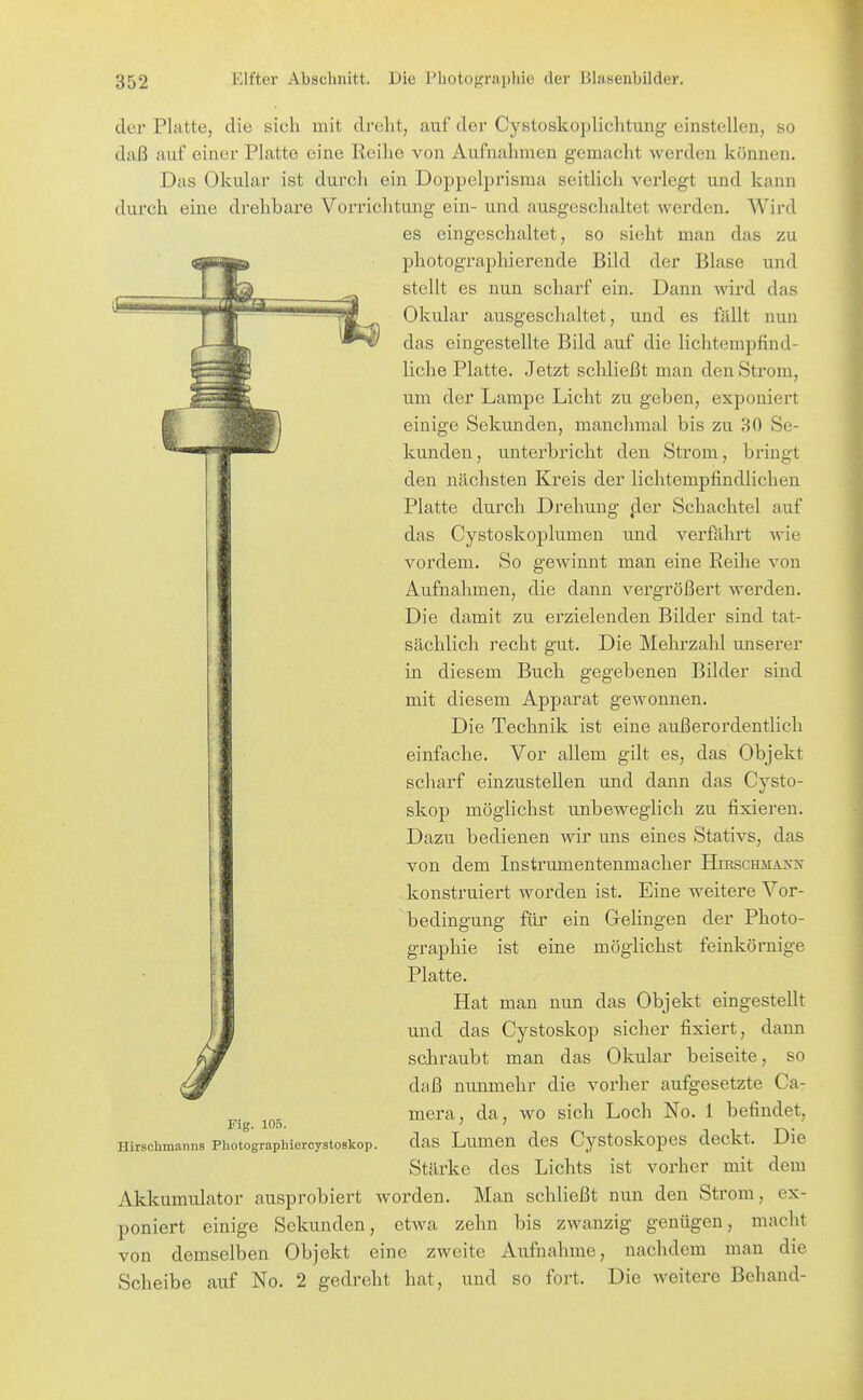 der Platte, die sich mit dreht, auf der Cystoskoplichtung einstellen, so daß auf einer Platte eine Reihe von Aufnahmen gemacht werden können. Das Okular ist durch ein Doppelprisma seitlich verlegt und kann durch eine drehbare Vorrichtung ein- und ausgeschaltet werden. Wird es eingeschaltet, so sieht man das zu photograplüerende Bild der Blase und stellt es nun scharf ein. Dann wird das Okular ausgeschaltet, und es fällt nun das eingestellte Bild auf die lichtempfind- liche Platte. Jetzt schließt man den Strom, um der Lampe Licht zu geben, exponiert einige Sekunden, manchmal bis zu 30 Se- kunden, unterbricht den Strom, bringt den nächsten Kreis der lichtempfindlichen Platte durch Drehung fler Schachtel auf das Cystoskoplumen und verfährt wie vordem. So gewinnt man eine Reihe von Aufnahmen, die dann vergrößert werden. Die damit zu erzielenden Bilder sind tat- sächlich recht gut. Die Mehrzahl unserer in diesem Buch gegebenen Bilder sind mit diesem Apparat gewonnen. Die Technik ist eine außerordentlich einfache. Vor allem gilt es, das Objekt scharf einzustellen und dann das Cysto- skop möglichst unbeweglich zu fixieren. Dazu bedienen wir uns eines Stativs, das von dem Instrumentenmacher Hjrschmais'n konstruiert worden ist. Eine weitere Vor- bedingung für ein Gelingen der Photo- graphie ist eine möglichst feinkörnige Platte. Hat man nun das Objekt eingestellt und das Cystoskop sicher fixiert, dann schraubt man das Okular beiseite, so daß nunmehr die vorher aufgesetzte Ca- mera, da, wo sich Loch No. 1 befindet, das Lumen des Cystoskopes deckt. Die Stärke des Lichts ist vorher mit dem Akkumulator ausprobiert worden. Man schließt nun den Strom, ex- poniert einige Sekunden, etwa zehn bis zwanzig genügen, macht von demselben Objekt eine zweite Aufnahme, nachdem man die Scheibe auf No. 2 gedreht hat, und so fort. Die weitere Behand- Fig. 105. Hirscbmanns Photographiercystoskop.