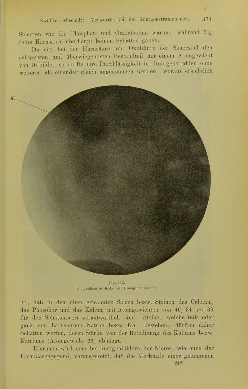 Schatten wie die Pliosphat- und Oxalatsteinc warfen, AviÜirend 5 g- reine Harnsäure überhaupt keinen Schatten gaben. Da nun bei der Harnsäure und Oxalsäure der Sauerstoff den schwersten und überwieg-endsten Bestandteil mit einem Atomgewicht von 16 bildet, so düi-fte ihre Durchlässigkeit für Röntgenstrahlen ohne weiteres als einander gleich angenommen werden, woraus ersichtlich Fig. 112. K. Oxalsaurer Kalk mit Phosphatüberzug. ist, daß in den oben erwähnten Salzen bezw. Steinen das Calcium, das Phosphor und das Kalium mit Atomgewichten von 40, 31 und 39 für den Schattenwert verantwortlich sind. Steine, welche teils oder ganz aus harnsaurem Natron bezw. Kali bestehen, dürften daher Schatten werfen, deren Stärke von der Beteiligung des Kaliums bezw. Natriums (Atomgewicht 23) abhängt. Hiernach Avird man bei Röntgenbildern der Nieren, wie auch der Harnblasengegend, vorausgesetzt, daß die Merkmale einer gelungenen 24*