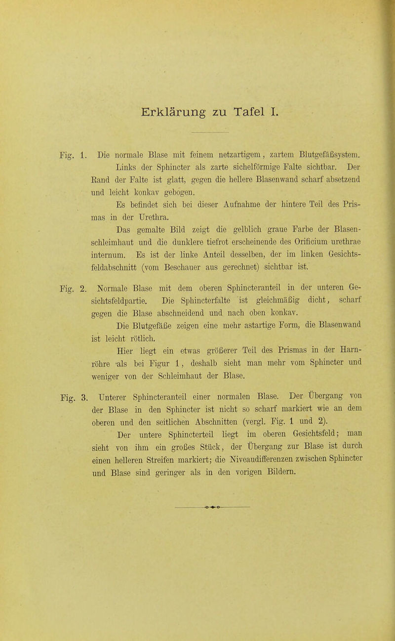 1. Die normale Blase mit feinem netzartigem, zartem Blutgefäßsystem. Links der Sphincter als zarte sichelförmige Falte sichtbar. Der Eand der Falte ist glatt, gegen die hellere Blasenwand scharf absetzend und leicht konkav gebogen. Es befindet sich bei dieser Aufnahme der hintere Teil des Pris- mas in der Urethra. Das gemalte Bild zeigt die gelblich graue Farbe der Blasen- Schleimhaut und die dunklere tiefrot erscheinende des Orificium urethrae internum. Es ist der linke Anteil desselben, der im linken Gesichts- feldabschnitt (vom Beschauer aus gerechnet) sichtbar ist. 2. Normale Blase mit dem oberen Sphincteranteil in der unteren Ge- sichtsfeldpartie. Die Sphincterfalte ist gleichmäßig dicht, scharf gegen die Blase abschneidend und nach oben konkav. Die Blutgefäße zeigen eine mehr astartige Form, die Blasenwand ist leicht rötlich. Hier liegt ein etwas größerer Teil des Prismas in der Harn- röhre -als bei Figur 1, deshalb sieht man mehr vom Sphincter und weniger von der Schleimhaut der Blase. 3. Unterer Sphincteranteil einer normalen Blase. Der Übergang von der Blase in den Sphincter ist nicht so scharf markiert wie an dem oberen und den seitlichen Abschnitten (vergl. Fig. 1 und 2). Der untere Sphincterteü liegt im oberen Gesichtsfeld; man sieht von ihm ein großes Stück, der Übergang zur Blase ist durch einen helleren Streifen markiert; die Niveaudifferenzen zwischen Sphincter und Blase sind geringer als in den vorigen Bildern.