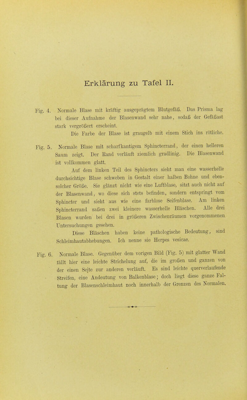 Yig. 4. Normale Blase mit kräftig ausgeprägtem Blutgefäß. Das Prisma lag bei dieser Aufnahme der Blaseuwand sehr nahe, sodaß der Gefäßast stark vergrößert erscheint. Die Farbe der Blase ist graugelb mit einem Stich ins rötliche. Fig. 5. Normale Blase mit scharfkantigem Sphincterrand, der einen helleren Saum zeigt. Der Eand verläuft ziemlich gradlinig. Die Blasenwand ist vollkommen glatt. Auf dem linken Teil des Sphincters sieht man eine wasserhelle durchsichtige Blase schweben in Gestalt einer halben Bohne und eben- solcher Größe. Sie glänzt nicht wie eine Luftblase, sitzt auch nicht auf der Blasenwand, wo diese sich stets befinden, sondern entspringt vom Sphincter und sieht aus wie eine farblose Seifenblase. Am linken Sphincterrand saßen zwei kleinere wasserhelle Bläschen. Alle drei Blasen wurden bei drei in größeren Zwischenräumen vorgenommenen. Untersuchungen gesehen. Diese Bläschen haben keine pathologische Bedeutung, sind Schleimhautabhebungen. Ich nenne sie Herpes vesicae. Fig. 6. Normale Blase. Gegenüber dem vorigen Bild (Fig. 5) mit glatter Wand täUt hier eine leichte Strichelung auf, die im großen und ganzen von der einen Seite zur anderen verläuft. Es sind leichte querverlaufende Streifen, eine Andeutung von Balkenblase; doch liegt diese ganze Fal- tung der Blasenschleimhaut noch innerhalb der Grenzen des Normalen.