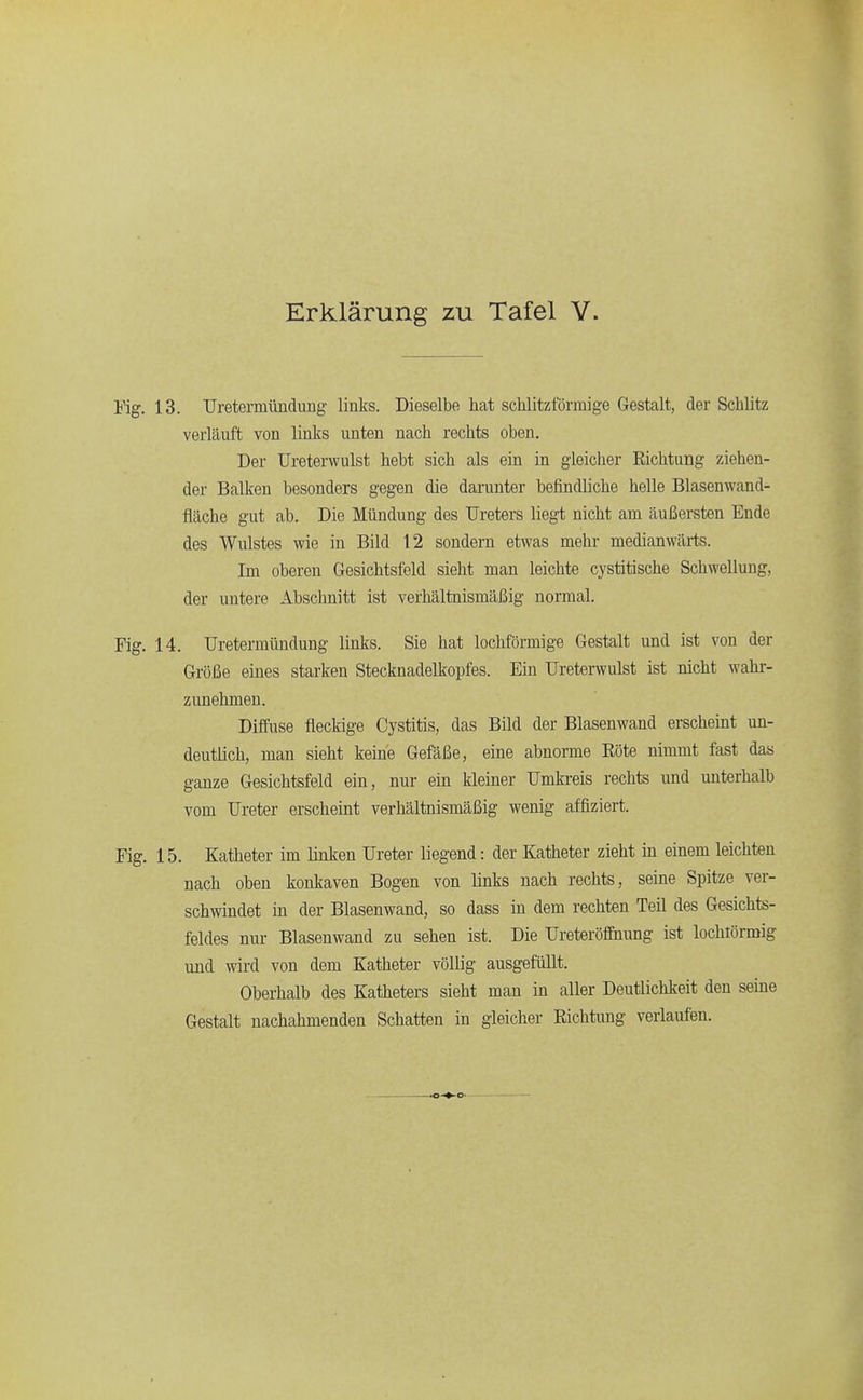 13. TJretermünduDg links. Dieselbe hat schlitzförmige Gestalt, der Schlitz verläuft von links unten nach rechts oben. Der Ureterwulst hebt sich als ein in gleicher Richtung ziehen- der Balken besonders gegen die darunter befindHche helle Blasenwand- fläche gut ab. Die Mündung des Ureters liegt nicht am cäußersten Ende des Wulstes wie in Bild 12 sondern etwas mehr medianwtärts. Im oberen Gesichtsfeld sieht man leichte cystitische Schwellung, der untere Abschnitt ist verhältnismäßig normal. 14. TJretermündung links. Sie hat lochförmige Gestalt und ist von der Größe eines starken Stecknadelkopfes. Ein Ureterwulst ist nicht wahr- zunehmen. Diffuse fleckige Cystitis, das Bild der Blasenwand erscheint un- deutlich, man sieht keine Gefäße, eine abnorme Eöte nimmt fast äaa ganze Gesichtsfeld ein, nur ein kleiner Umkreis rechts und unterhalb vom Ureter erscheint verhältnismäßig wenig affiziert. 15. Katheter im linken Ureter liegend: der Katheter zieht in einem leichten nach oben konkaven Bogen von ünks nach rechts, seine Spitze ver- schwindet in der Blasenwand, so dass in dem rechten Teil des Gesichts- feldes nur Blasenwand zu sehen ist. Die Ureteröffnung ist lochiörmig und wird von dem Katheter völlig ausgefüllt. Oberhalb des Katheters sieht man in aller Deutlichkeit den seine Gestalt nachahmenden Schatten in gleicher Richtimg verlaufen.