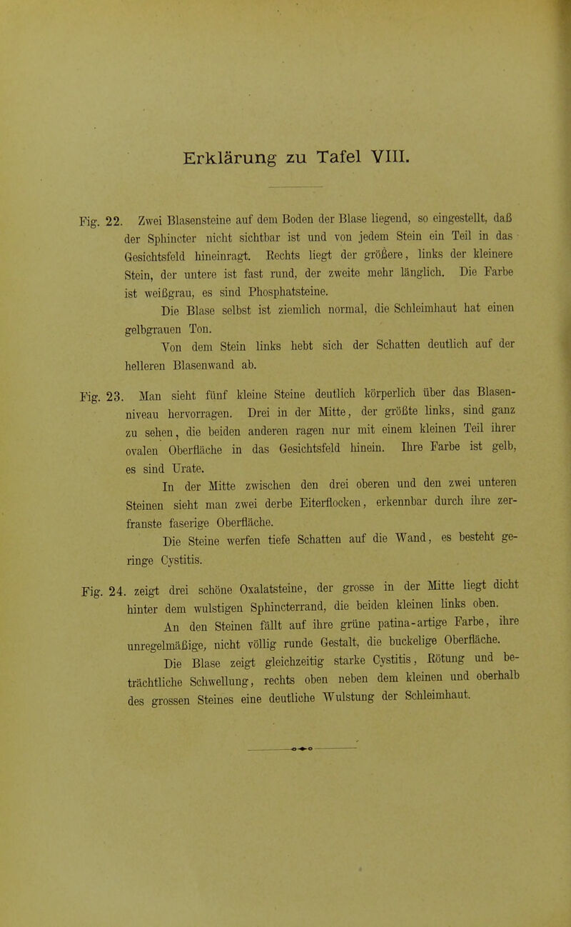 Fig. 22. Zwei Blasensteine auf dem Boden der Blase liegend, so eingestellt, daß der Sphincter nicht sichtbar ist und von jedem Stein ein Teil in das Gesichtsfeld hineinragt. Rechts liegt der größere, links der kleinere Stein, der untere ist fast rund, der zweite mehr länglich. Die Farbe ist weißgrau, es sind Phosphatsteine. Die Blase selbst ist ziemlich normal, die Schleimhaut hat einen gelbgrauen Ton. Yon dem Stein links hebt sich der Schatten deutlich auf der helleren Blasenwand ab. Fig. 23. Man sieht fünf kleine Steine deutlich körperlich über das Blasen- niveau hervorragen. Drei in der Mitte, der größte links, sind ganz zu sehen, die beiden anderen ragen nur mit einem kleinen Teil ihrer ovalen Oberfläche in das Gesichtsfeld hinein. Ihre Farbe ist gelb, es sind TJrate. In der Mitte zwischen den drei oberen und den zwei unteren Steinen sieht man zwei derbe Eitei-flocken, erkennbar durch ihi-e zer- franste faserige Oberfläche. Die Steine werfen tiefe Schatten auf die Wand, es besteht ge- ringe Cystitis. Fig. 24. zeigt di-ei schöne Oxalatsteine, der grosse in der Mitte liegt dicht hinter dem wulstigen Sphincterrand, die beiden kleinen links oben.^ An den Steinen fällt auf ihre grüne patina-artige Farbe, ihre unregelmäßige, nicht völlig runde Gestalt, die buckelige Oberfläche. Die Blase zeigt gleichzeitig starke Cystitis, ßötiing und be- trächtiiche Schwellung, rechts oben neben dem kleinen und oberhalb des grossen Steines eine deutiiche Wulstung der Schleimhaut.
