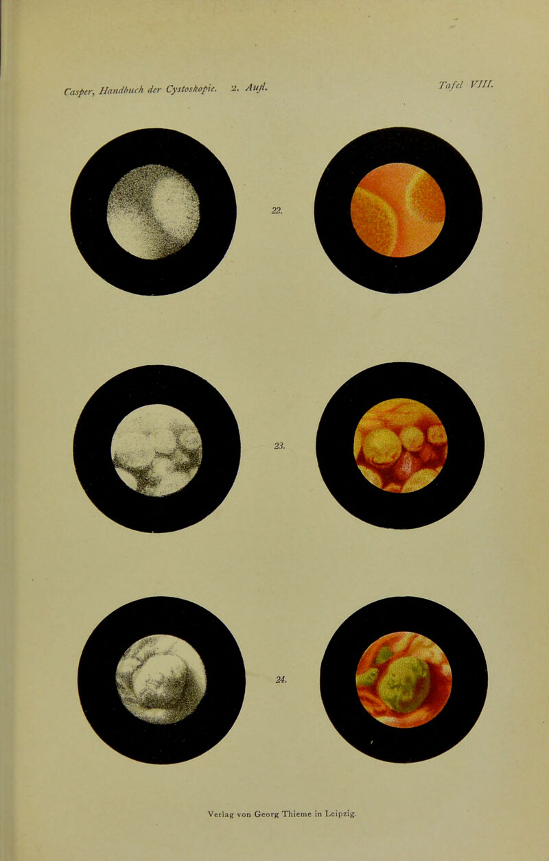 Casper, Handbuch der Cystoskopie. a. Auß.