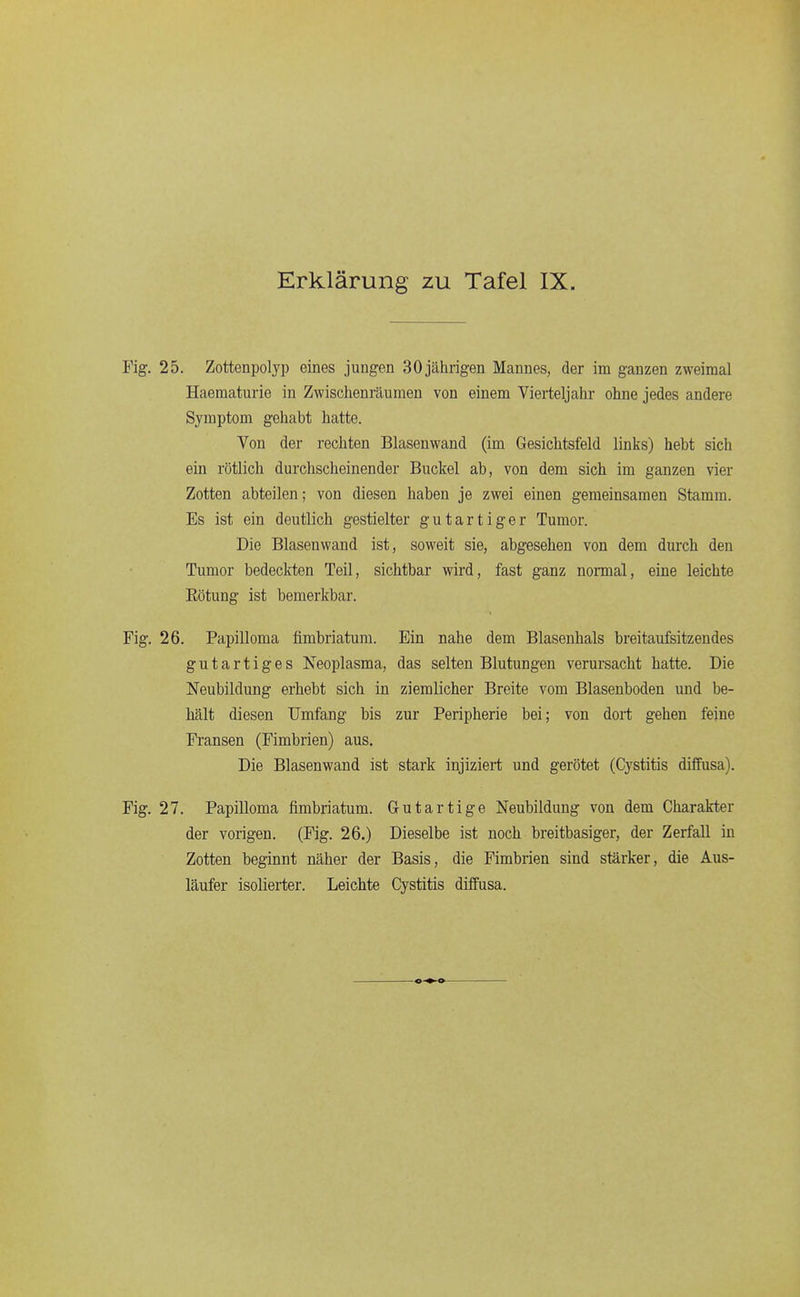 Fig. 25. Zottenpolyp eines jungen 30jährigen Mannes, der im ganzen zweimal Haeraaturie in Zwischenräumen von einem Vierteljahr ohne jedes andere Symptom gehabt hatte. Von der rechten Blasenwand (im Gesichtsfeld links) hebt sich ein rötlich durchscheinender Buckel ab, von dem sich im ganzen vier Zotten abteilen; von diesen haben je zwei einen gemeinsamen Stamm. Es ist ein deutlich gestielter gutartiger Tumor. Die Blasenwand ist, soweit sie, abgesehen von dem durch den Tumor bedeckten Teil, sichtbar wird, fast ganz nonnal, eine leichte Eötung ist bemerkbar. Fig. 26. Papilloma fimbriatum. Ein nahe dem Blasenhals breitaufsitzendes gutartiges Neoplasma, das selten Blutungen verursacht hatte. Die Neubildung erhebt sich in ziemlicher Breite vom Blasenboden und be- hält diesen Umfang bis zur Peripherie bei; von dort gehen feine Fransen (Fimbrien) aus. Die Blasenwand ist stark injiziert und gerötet (Cystitis diffusa). Fig. 27. Papilloma fimbriatum. Gutartige Neubildung von dem Charakter der vorigen. (Fig. 26.) Dieselbe ist noch breitbasiger, der Zerfall in Zotten beginnt näher der Basis, die Fimbrien sind stärker, die Aus- läufer isolierter. Leichte Cystitis diffusa.