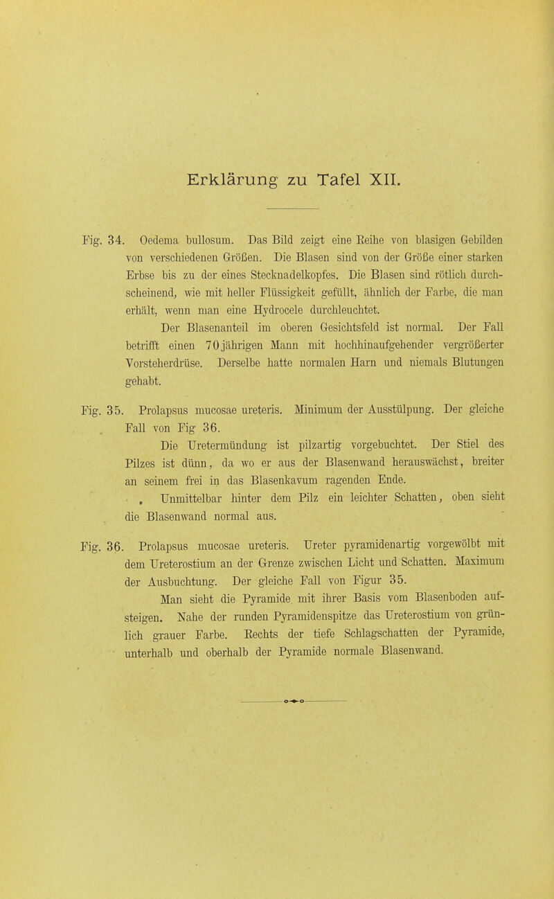 34. Oedema bullosum. Das Bild zeigt eine Eeihe von blasigen Gebilden von verschiedenen Größen. Die Blasen sind von der Größe einer starken Erbse bis zu der eines Stecknadelkopfes. Die Blasen sind rötlich durch- scheinendj wie mit heller Flüssigkeit gefüllt, ähnlich der Farbe, die man erhält, wenn man eine Hydrocele durchleuchtet. Der Blasenanteil im oberen Gesichtsfeld ist normal. Der Fall betrifft einen 70 jährigen Mann mit bochhinaufgehender vergrößerter Vorsteherdrüse. Derselbe hatte normalen Harn und niemals Blutungen gehabt. 35. Prolapsus mucosae ureteris. Minimum der Ausstülpung. Der gleiche Fall von Fig 36. Die Uretermündung ist pilzartig vorgebuchtet. Der Stiel des Pilzes ist dünn, da wo er aus der Blasenwand herauswächst, breiter an seinem frei in das Blasenkavum ragenden Ende. , Unmittelbar hinter dem Pilz ein leichter Schatten, oben sieht die Blasenwand normal aus. 36. Prolapsus mucosae ureteris. Ureter pyramidenartig vorgewölbt mit dem Ureterostium an der Grenze zwischen Licht und Schatten. Maximum der Ausbuchtung. Der gleiche Fall von Figur 35. Man sieht die Pyramide mit ihrer Basis vom Blasenboden auf- steigen. Nahe der runden Pyramidenspitze das Ureterostium von grün- lich gi-auer Farbe. Eechts der tiefe Schlagschatten der Pyi-amide, unterhalb und oberhalb der Pyramide normale Blasenwand.
