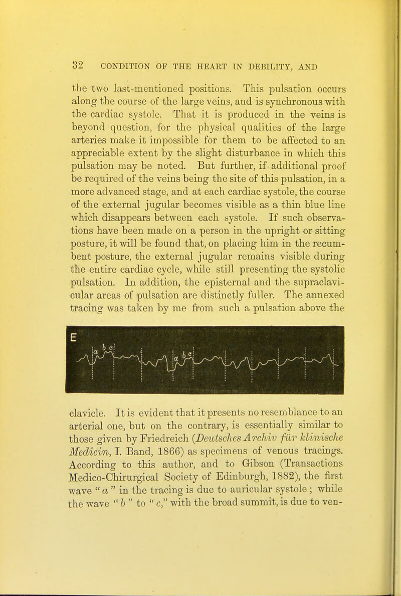 the two last-mentioned positions. This pulsation occurs along the course of the large veins, and is synchronous with the cardiac systole. That it is produced in the veins is beyond question, for the physical qualities of the large arteries make it impossible for them to be affected to an appreciable extent by the slight disturbance in which this pulsation may be noted. But further, if additional proof be required of the veins being the site of this pulsation, in a more advanced stage, and at each cardiac systole, the course of the external jugular becomes visible as a thin blue line which disappears between each systole. If such observa- tions have been made on a person in the upright or sitting posture, it will be found that, on placing him in the recum- bent posture, the external jugular remains visible during the entire cardiac cycle, while still presenting the systolic pulsation. In addition, the episternal and the supraclavi- cular areas of pulsation are distinctly fuller. The annexed tracing was taken by me from such a pulsation above the clavicle. It is evident that it presents no resemblance to an arterial one, but on the contrary, is essentially similar to those given by Friedreich (Deutsches Archiv fur klinische Medicin, I. Band, 1866) as specimens of venous tracings. According to this author, and to Gibson (Transactions Medico-Chirurgical Society of Edinburgh, 1S82), the first wave  a  in the tracing is due to auricular systole ; while the wave  b  to  c, with the broad summit, is due to ven-