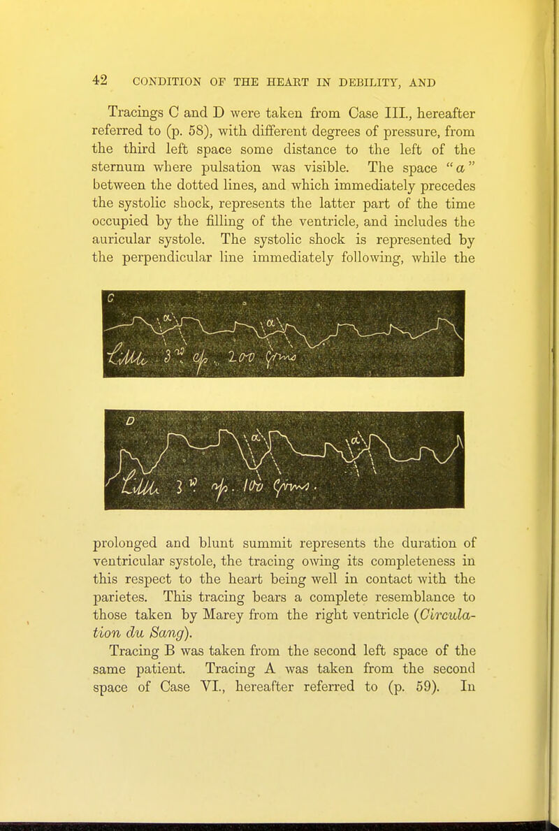 Tracings C and D were taken from Case III., hereafter referred to (p. 58), with different degrees of pressure, from the third left space some distance to the left of the sternum where pulsation was visible. The space a between the dotted lines, and which immediately precedes the systolic shock, represents the latter part of the time occupied by the filling of the ventricle, and includes the auricular systole. The systolic shock is represented by the perpendicular line immediately following, while the > prolonged and blunt summit represents the duration of ventricular systole, the tracing owing its completeness in this respect to the heart being well in contact with the parietes. This tracing bears a complete resemblance to those taken by Marey from the right ventricle (Circula- tion du Sang). Tracing B was taken from the second left space of the same patient. Tracing A was taken from the second space of Case VI., hereafter referred to (p. 59). In