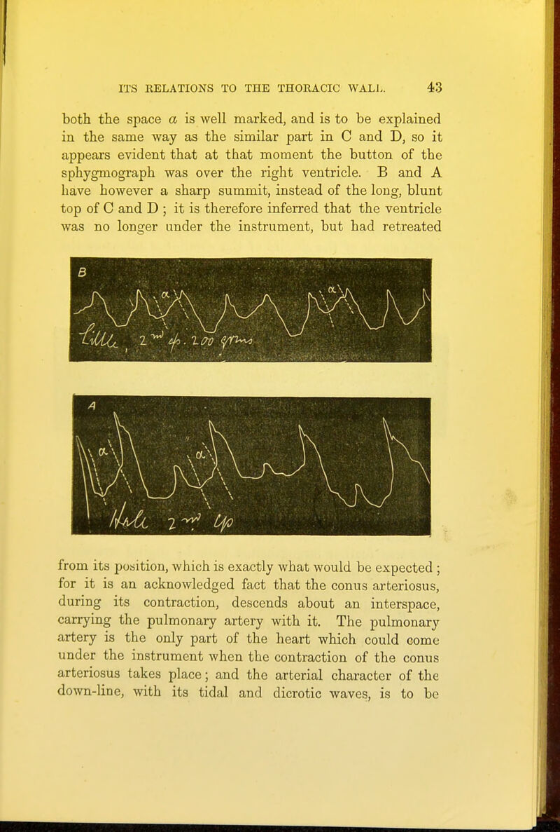 both the space a is well marked, and is to be explained in the same way as the similar part in C and D, so it appears evident that at that moment the button of the sphygmograph was over the right ventricle. B and A have however a sharp summit, instead of the long, blunt top of C and D ; it is therefore inferred that the ventricle was no longer under the instrument, but had retreated from its position, which is exactly what would be expected ; for it is an acknowledged fact that the conus arteriosus, during its contraction, descends about an interspace, carrying the pulmonary artery with it. The pulmonary artery is the only part of the heart which could come under the instrument when the contraction of the conus arteriosus takes place; and the arterial character of the down-line, with its tidal and dicrotic waves, is to be