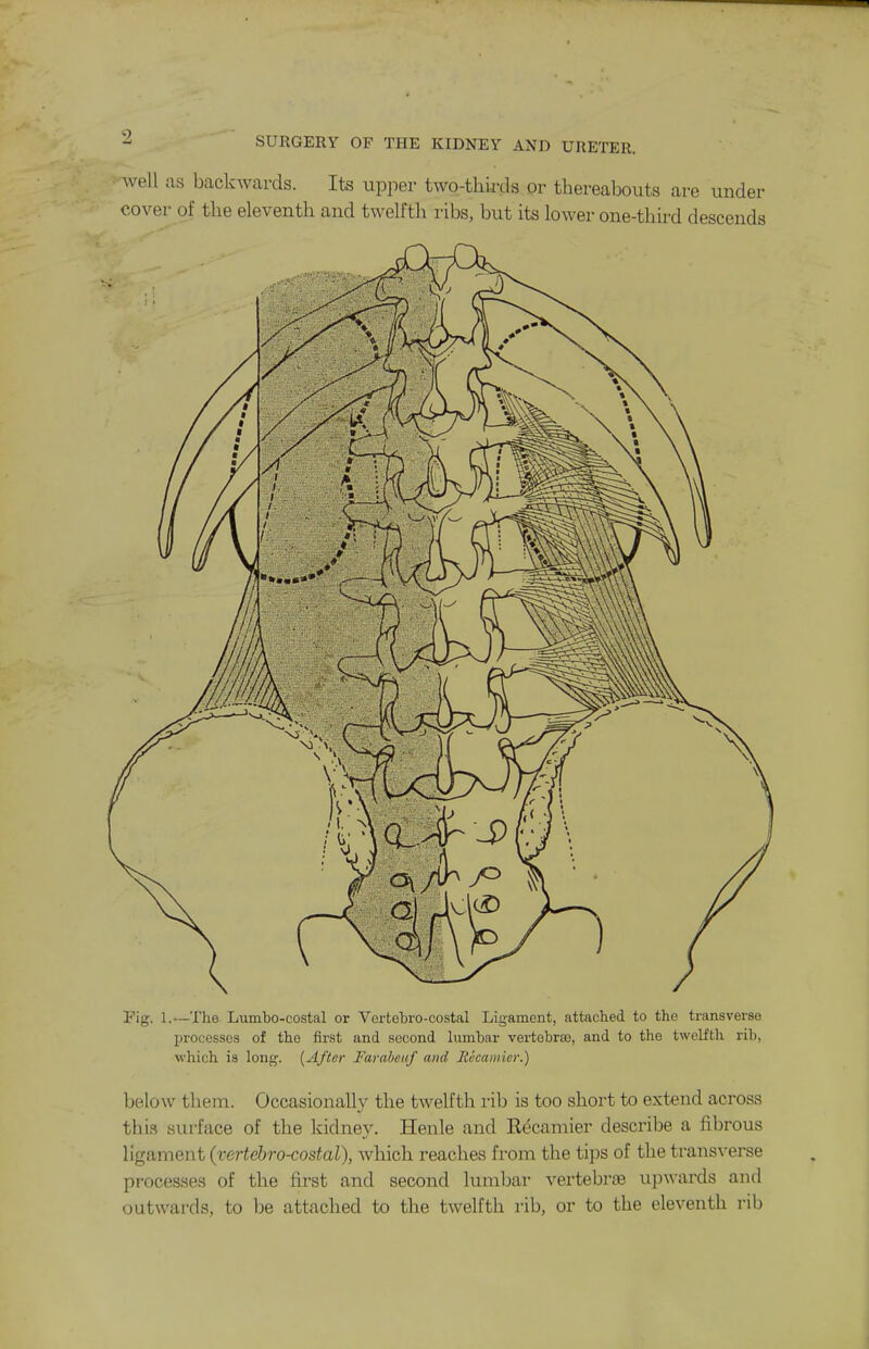 9 SURGERY OF THE KIDNEY AND URETER. well as backwards. Its upper two-thirds or thereabouts are under cover of the eleventh and twelfth ribs, but its lower one-third descends Fig. 1.—The Lumto-costal or Vertebro-costal Ligament, attached to the transverse processes of the first and second lumbar vertebrae, and to the twclftli rib, which is long. {After FarabcuJ and Ttecamier.) below them. Occasionally the twelfth rib is too short to extend across this surface of the kidney. Henle and E^camier describe a fibrous ligament (vertebro-costal), which reaches from the tips of the trans\-erse processes of the first and second lumbar vertebroe upwards and outwards, to be attached to the twelfth rib, or to the eleventh rib