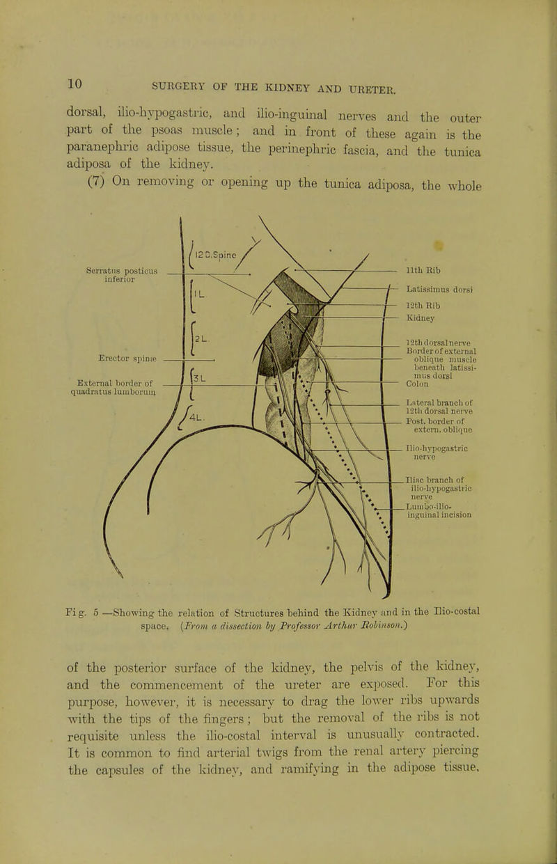 dorsal, ilio-liypogastric, and ilio-inguiiml nerves and the outer part of the psoas muscle; and in front of these again is the paranephric adipose tissue, the perinephric fascia, and the tunica adiposa of the kidney. (7) On removing or opening up the tunica adiposa, the whole Serratns posticus inferior Erector sjunie External border of quadratus lumboruui nth Rib Latissimus dorsi 12tli Rib Kidney IStluIorsal nerve Border of external oblique muscle beneath latissi- mus dorsi Colon Lnteral branch of 12tli dorsal nerve Post, border of extern, oblique —J Ilin-hypogastric I nerve Ilinc branch of ilio-hypogastric nerve Lumbo-ilio- ingiiinal incision Fi g. 5 —Showing the relation of Structures behind the Kidney and in the Ilio-costal space, {From a dissection hy Professor Arthur Jiobiiisoii.) of the posterior surface of the kidney, the pelvis of the kidney, and the commencement of the ureter are exposed. For this purpose, however, it is necessary to drag the lower ribs upwards with the tips of the fingers; but the removal of the ribs is not requisite unless the ilio-costal interval is unusually contracted. It is common to find arterial twigs from the renal artery piercing the capsules of the kidney, and ramifying in the adipose tissue.