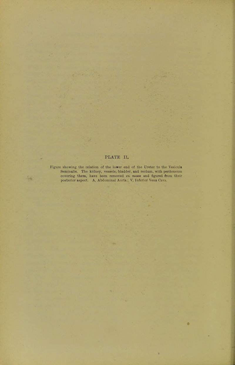 PLATE II. Figure showing the relation of the lower end of the Ureter to the Vesicula Seminalis. The kidney, vessels, bladder, and rectum, with peritoneum covering them, have been removed en masse and figured from their posterior aspect. A, Abdominal Aorta; V, Inferior Vena Cava.