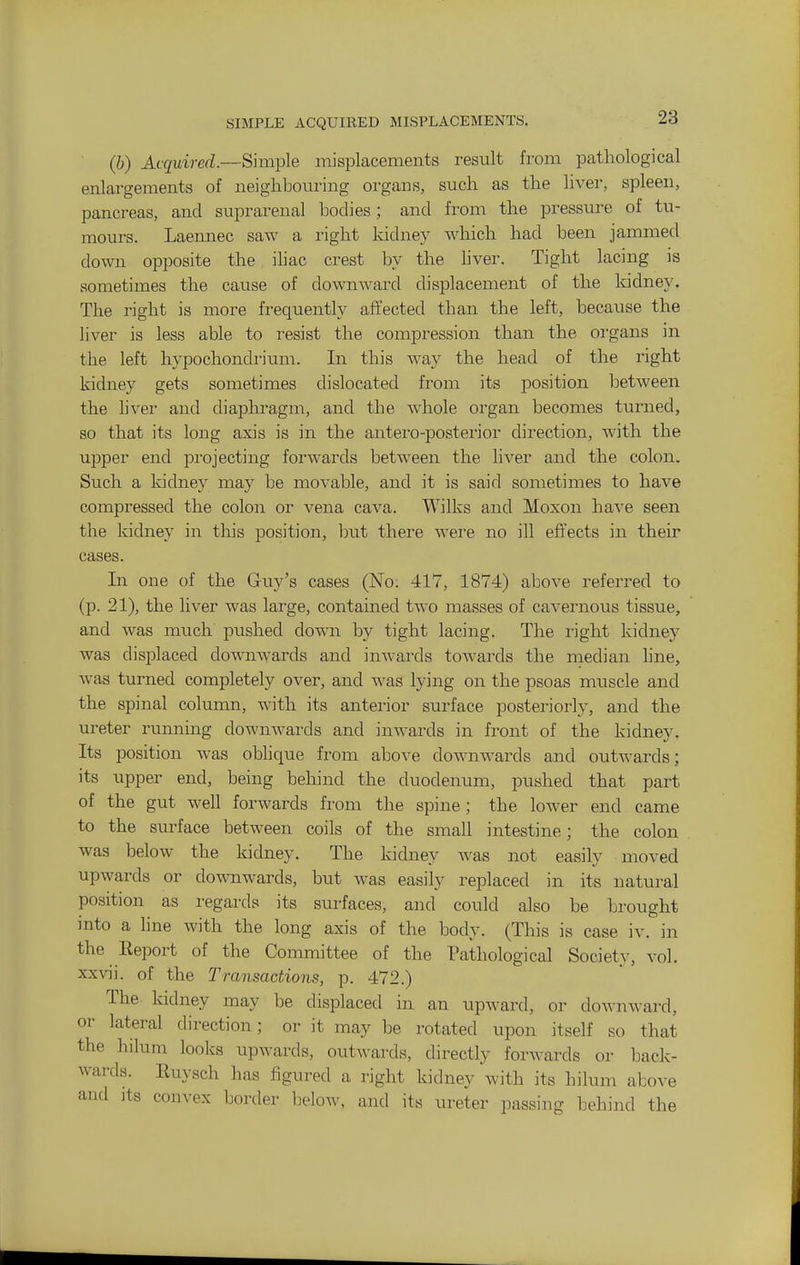 (b) Acquired.—Simple misplacements result from pathological enlargements of neighbouring organs, such as the livei-, spleen, pancreas, and suprarenal bodies; and from the pressure of tu- mours. Laennec saw a right kidney which had been jammed down opposite the iliac crest by the liver. Tight lacing is sometimes the cause of downward displacement of the kidney. The right is more frequently affected than the left, because the liver is less able to resist the compression than the organs in the left hypochondrium. In this way the head of the right kidney gets sometimes dislocated from its position between the liver and diaphragm, and the whole organ becomes turned, so that its long axis is in the antero-posterior direction, with the upper end projecting forwards between the liver and the colon. Such a kidney may be movable, and it is said sometimes to have compressed the colon or vena cava. Wilks and Moxon have seen the kidney in this position, but there were no ill effects in their cases. In one of the Guy's cases (No. 417, 1874) above referred to (p. 21), the liver was large, contained two masses of cavernous tissue, and was much pushed down by tight lacing. The i-ight kidney was displaced downwards and inwards towards the median line, was turned completely over, and was lying on the psoas muscle and the spinal column, with its anterior surface posteriorly, and the ureter running dowuAvards and inwards in front of the kidney. Its position was oblique from above downwards and outwards; its upper end, being behind the duodenum, pushed that part of the gut well forwards from the spine; the lower end came to the surface between coils of the small intestine; the colon was below the kidney. The kidney was not easily moved upwards or downwards, but was easily replaced in its natural position as regards its surfaces, and could also be brought into a line with the long axis of the body. (This is case iv. in the Report of the Committee of the Pathological Society, vol. xxvii. of the Transactions, p. 472.) The kidney may be displaced in an upward, or downwai-d, or lateral direction; or it may be rotated upon itself so that the hilum looks upwards, outwards, directly forwards or back- wards. Ruysch has figured a right kidney with its hilum above and Its convex border below, and its ureter passing behind the