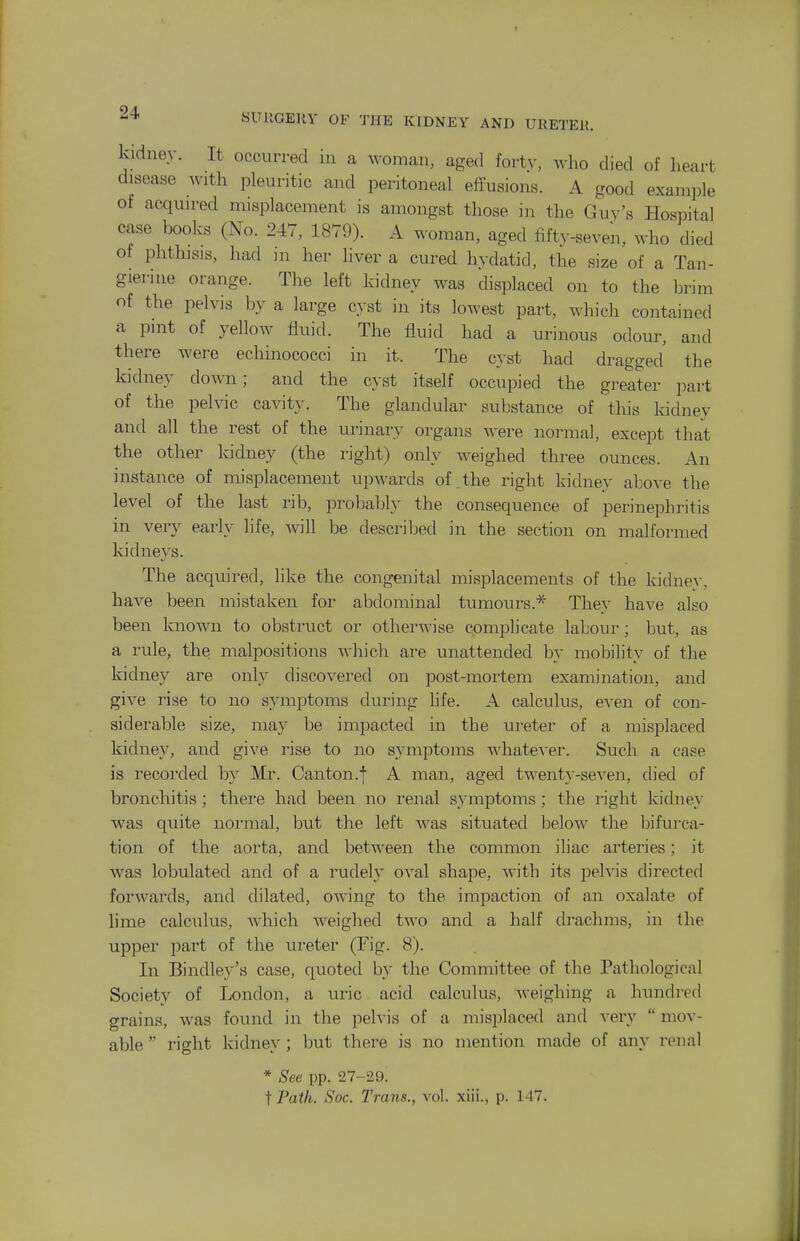 kidney. It occurred in a woman, aged forty, who died of heart disease with pleuritic and peritoneal effusions. A good example of acquired misplacement is amongst those in the Guy's Hospital case books (No. 247, 1879). A woman, aged fifty-seven, who died ot phthisis, had m her liver a cured hydatid, the size of a Tan- gierine orange. The left kidney was displaced on to the brim of the pelvis by a large cyst in its lowest part, which contained a pint of yellow fluid. The fluid had a urinous odour, and there were echinococci in it. The cyst had dragged the kidney down; and the cyst itself occupied the greater part of the pelvic cavity. The glandular substance of this kidney and all the rest of the urinary organs were normal, except that the other kidney (the right) only weighed three ounces. An instance of misplacement upwards of . the right kidney above the level of the last rib, probably the consequence of perinephritis in very early life, will be described in the section on malformed kidneys. The acquired, like the congenital misplacements of the kidney, have been mistaken for abdominal tumours.* They have also been known to obstruct or otherwise complicate labour ; but, as a rule, the malpositions which are unattended by mobility of the kidney are only discovered on post-mortem examination, and give rise to no symptoms during life. A calculus, even of con- siderable size, may be impacted in the ureter of a misplaced kidney, and give rise to no symptoms whatever. Such a case is I'ecorded by Mr. Canton.f A man, aged twenty-seven, died of bronchitis ; there had been no renal symptoms ; the right kidney was quite noi-mal, but the left was situated below the bifui-ca- tion of the aorta, and between the common iliac arteries; it was loljulated and of a rudely oval shape, with its jDclvis directed forwards, and dilated, owing to the impaction of an oxalate of lime calculus, which weighed two and a half drachms, in the upper part of the ureter (Fig. 8). In Bindley's case, quoted by the Committee of the Pathological Society of London, a uric acid calculus, weighing a hundred grains, was found in the pelvis of a misplaced and very  mov- able  right kidney ; but there is no mention made of any renal * See pp. 27-29. t Path. Soc. Trails., vol. xiii., p. 147.