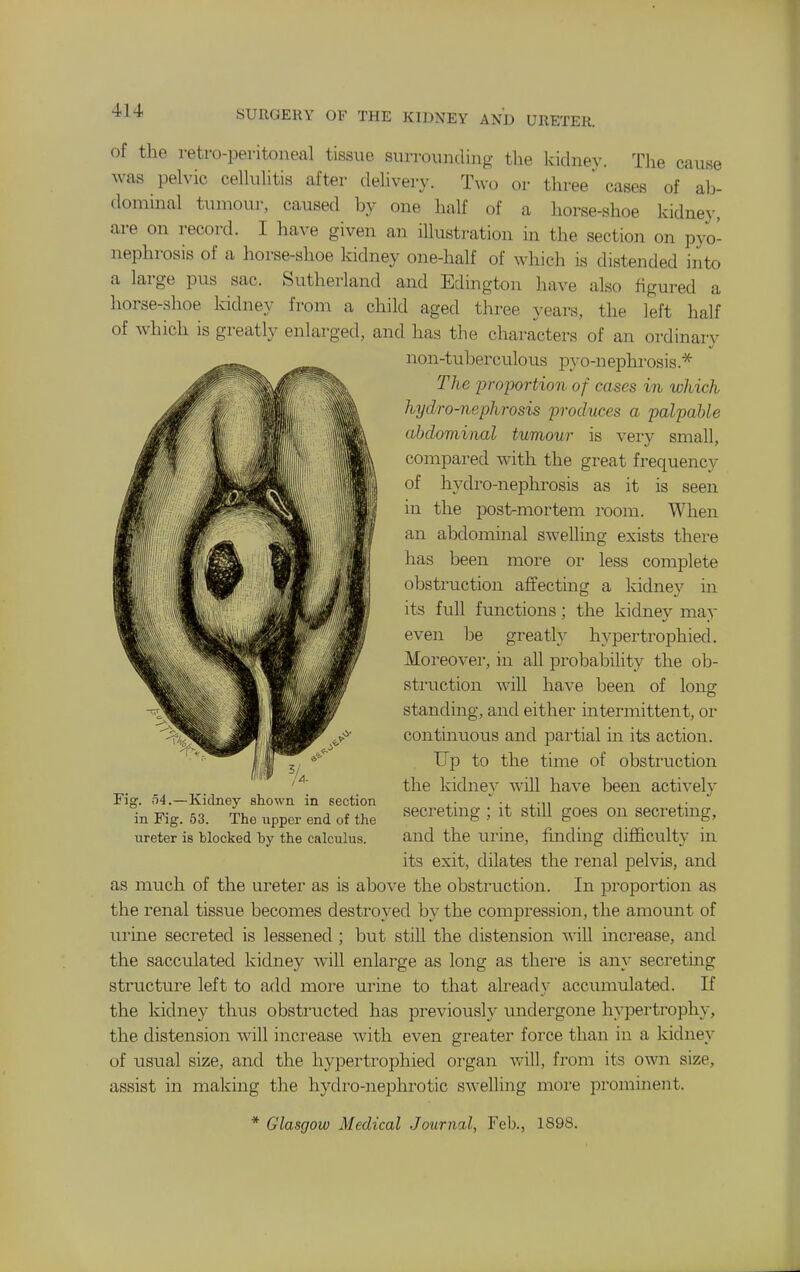 of the retro-peritoneal tissue surrounding the kidney. The cause was pelvic cellulitis after deUvery. Two or three' cases of ah- dominal tumour, caused by one half of a horse-shoe kidney, are on record. I have given an illustration in the section on pyo- nephrosis of a horse-shoe kidney one-half of which is distended into a large pus sac. Sutherland and Edington have also figured a horse-shoe kidney from a child aged three years, the left half of which is greatly enlarged, and has the characters of an ordinarv non-tuberculous pyo-n ephrosis The proportion of cases in which hydro-nephrosis produces a palpable abdominal tumour is very small, compared with the great frequency of hydro-nephrosis as it is seen in the post-mortem room. When an abdominal swelling exists there has been more or less complete obstruction affecting a kidney in its full functions; the kidney may even be greatly hyper trophied. Moreover, in all probability the ob- struction will have been of long standing, and either intermittent, or continuous and partial in its action. Up to the time of obstruction the kidnev will have been actively secreting ; it still goes on secreting, and the ui-ine, finding difficulty in its exit, dilates the renal pelvis, and as much of the ureter as is above the obstruction. In proportion as the renal tissue becomes destroyed by the compression, the amount of urine secreted is lessened ; but still the distension -nnll increase, and the sacculated kidney Avill enlarge as long as there is any secretmg structure left to add more urine to that ali'eady accumulated. If the kidney thus obsti'ucted has previously undergone hypertrophy, the distension will increase with even greater force than in a kidney of usual size, and the hypertrophied organ will, from its own size, assist in making the hydi-o-nephrotic swelling more prominent. Fig. 54.—Kiclney shown in section in Fig. 53. The iipper end of the ureter is blocked by the calculus.