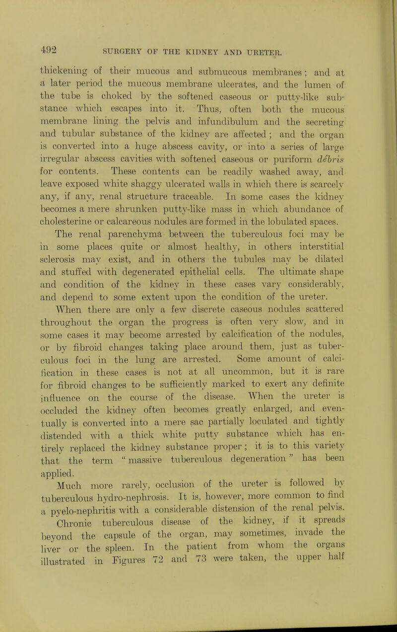 thickening of their mucous and submucous membranes ; and at a later period the mucous membrane ulcerates, and the lumen of the tube is choked by the softened caseous or putty-like sul)- stance which escapes into it. Thus, often both the mucous membrane lining the pelvis and infundibulum and the secreting and tubular substance of the kidney are affected ; and the organ is converted into a huge abscess cavity, or into a series of large irregular abscess cavities with softened caseous or puriform dehrin for contents. These contents can be readily washed away, and leave exposed white shaggy ulcerated walls in which there is scarcely any, if any, renal structure traceable. In some cases the kidney becomes a mei'e shrimken putty-like mass in which abundance of cliolesterine or calcareous nodules are formed in the lobulated spaces. The renal parenchyma between the tuberculous foci may be in some places quite or almost health}^, in others interstitial sclerosis may exist, and in others the tubules may be dilated and stuffed with degenerated epithelial cells. The ultimate shape and condition of the kidney in these cases vary considerably, and depend to some extent upon the condition of the ureter. When there are only a few discrete caseous nodules scattered throughout the organ the progress is often very slow, and in some cases it may become arrested by calcification of the nodules, or by fibroid changes taking place around them, just as tuber- culous foci in the lung are arrested. Some amount of calci- fication in these cases is not at all uncommon, but it is rare for fibroid changes to be sufficiently marked to exert any definite influence on the course of the disease. When the ureter is occluded the kidney often becomes greatly enlarged, and even- tually is converted into a mere sac partially loculated and tightly distended with a thick white putty substance which has en- tirely replaced the kidney substance proper; it is to this variety that the term massive tuberculous degeneration has been applied. Much more rarely, occlusion of the ureter is followed b}- tuberculous hydro-nephrosis. It is, however, more common to find a pyelo-nephritis with a considerable distension of the renal pelvis. Chronic tuberculous disease of the kidney, if it spreads l)eyond the capsule of the organ, may sometimes, invade the liver or the spleen. In the patient from whom the organs illustrated in Figures 72 and 73 were taken, the upper half